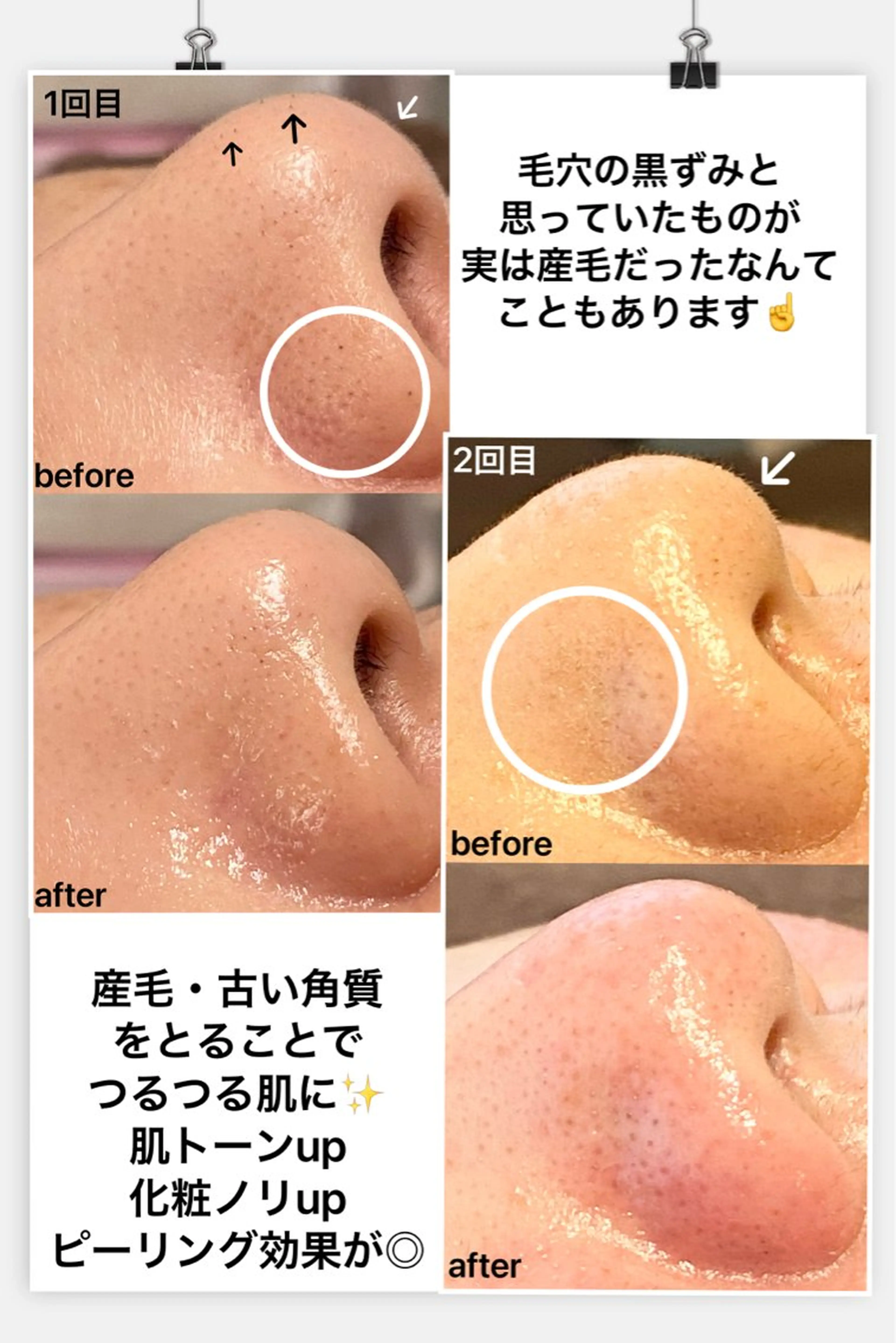 眉毛×小顔矯正サロン パピヨンsakiのエステ・リラクイメージ