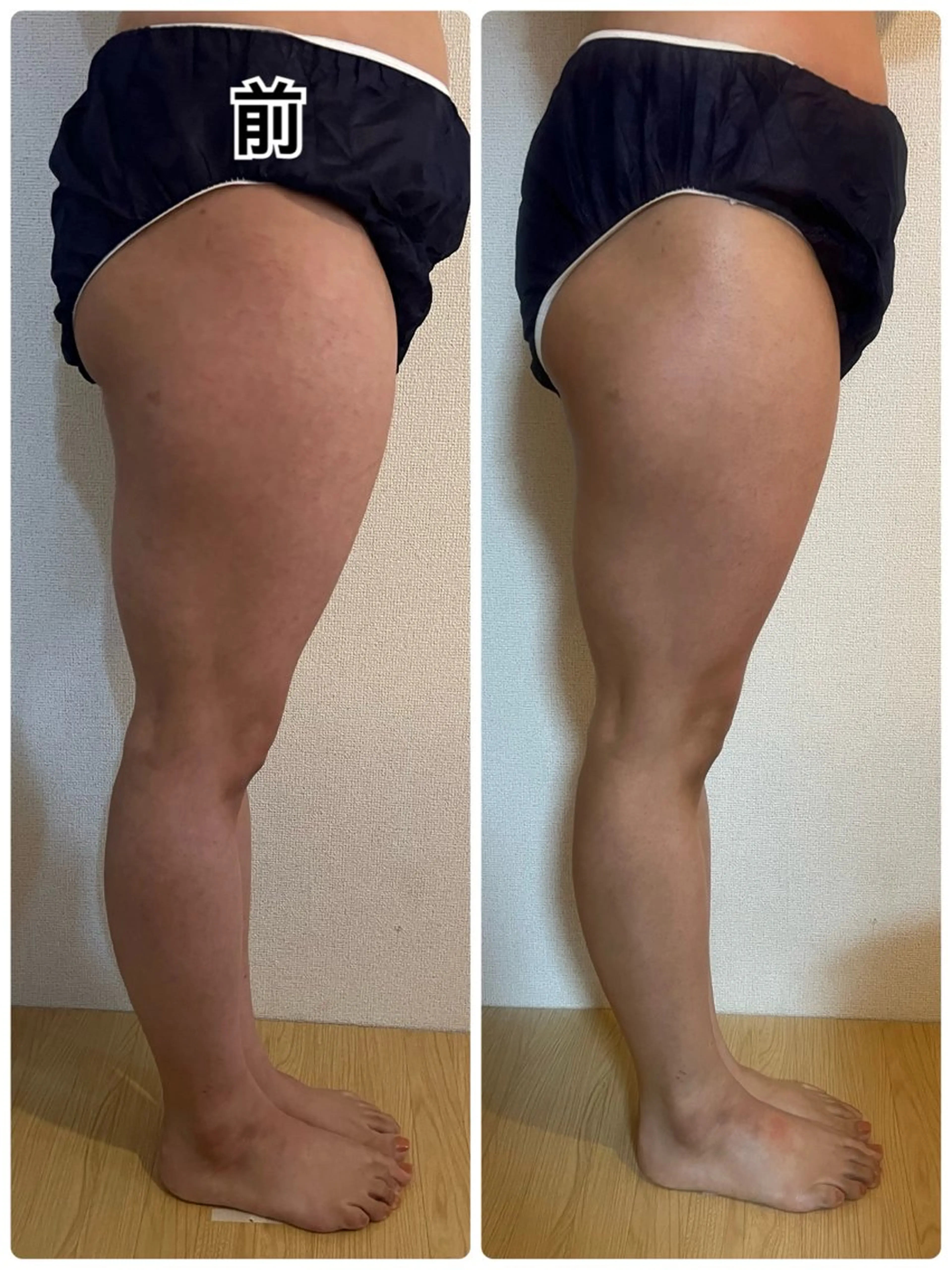 ❤︎MN❤︎ モンのエステ・リラクイメージ