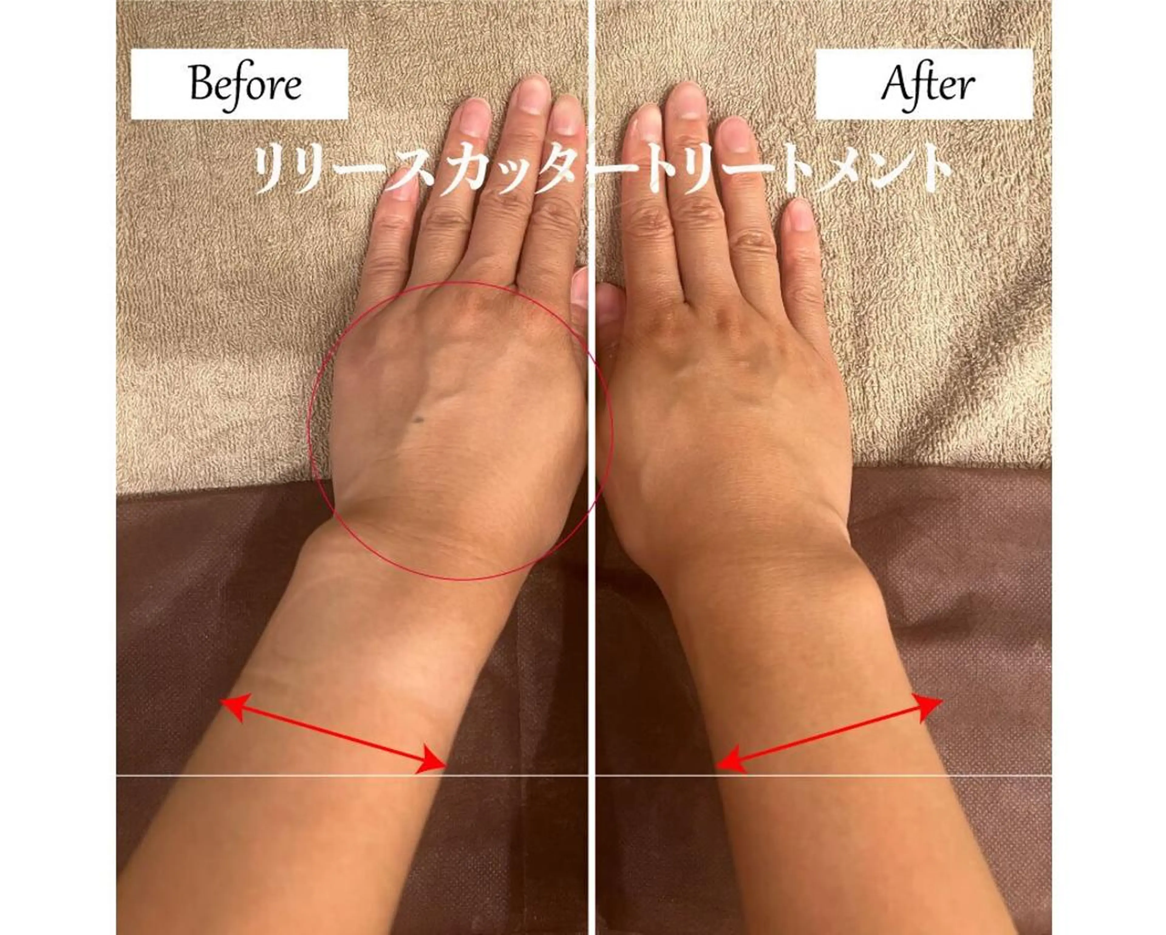 ブライダルサロン ｜Lino【堀江】のエステ・リラクイメージ