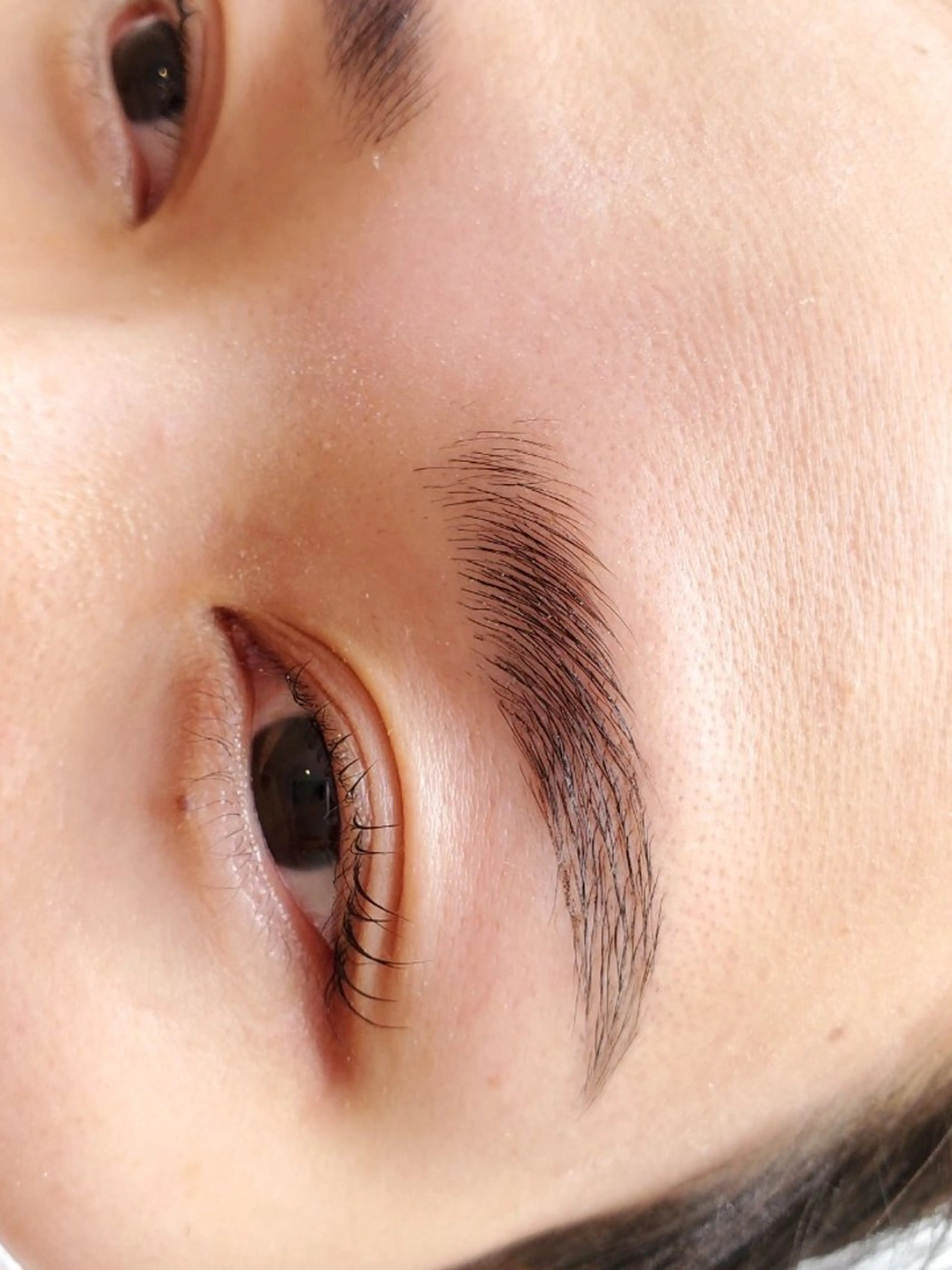 ブロウリフトの写真