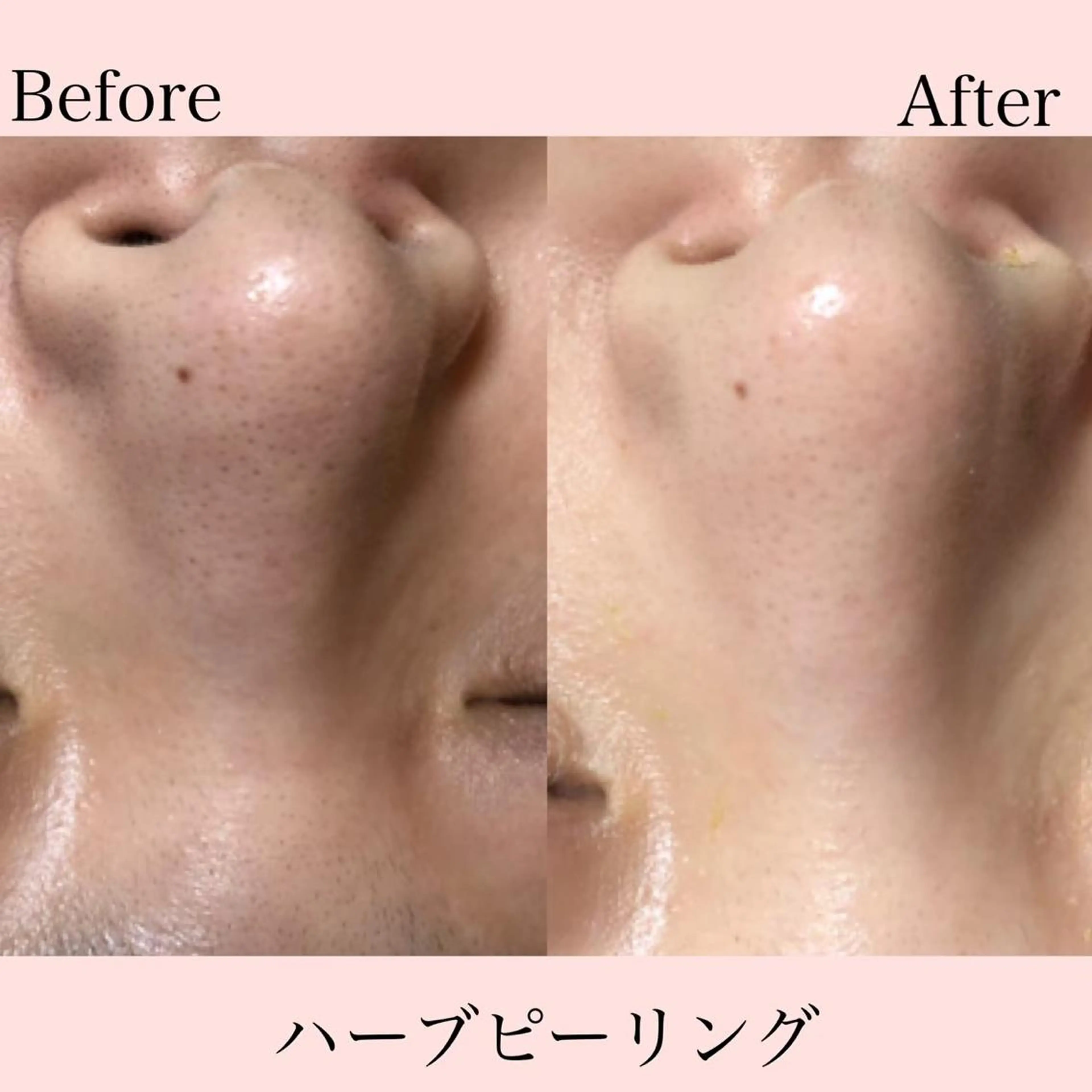 エステ パーソナルカラー診断 Petit六本木のマツエク・マツパデザイン