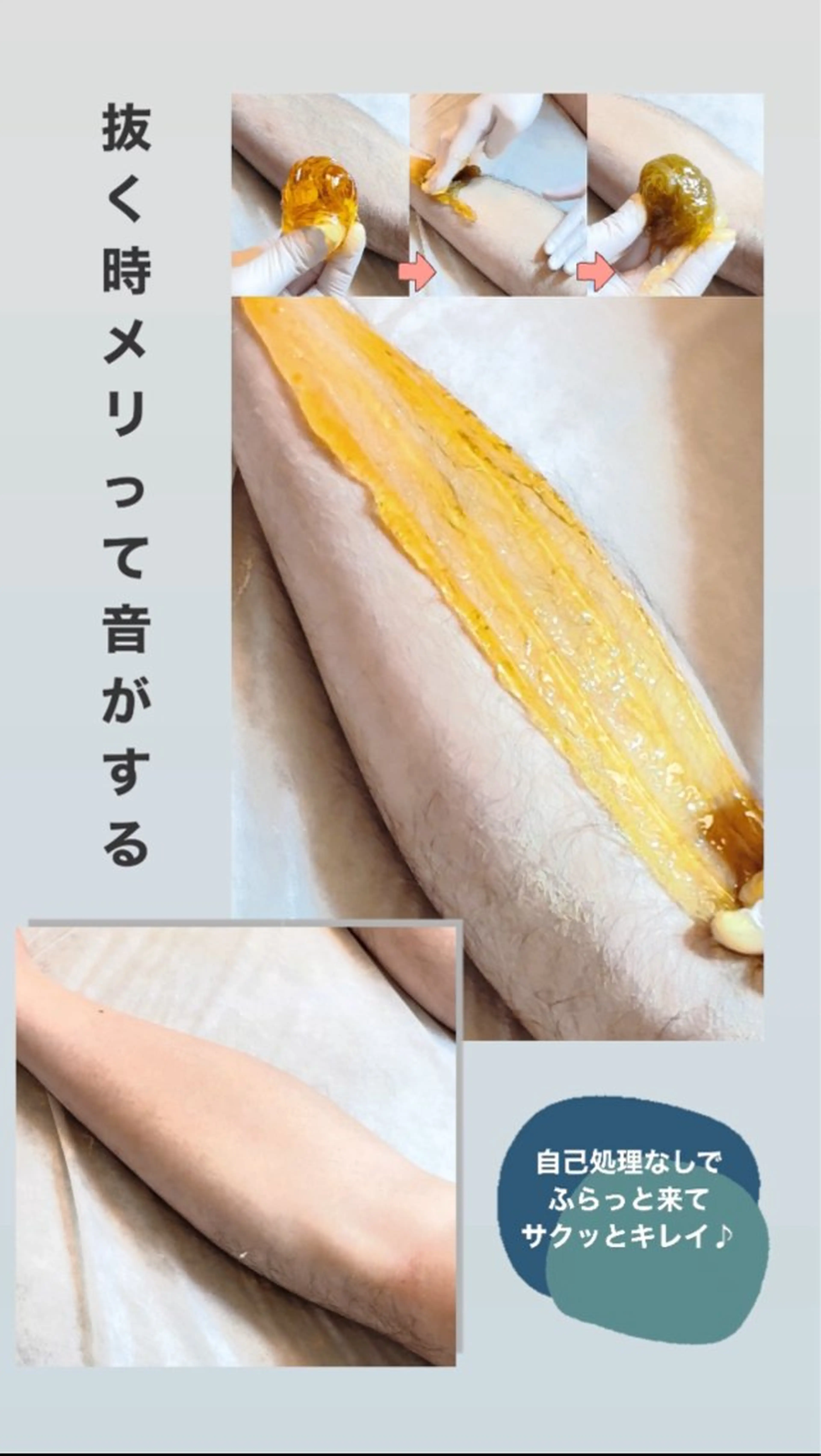 Hitomi シュガーリング豊橋のその他イメージ