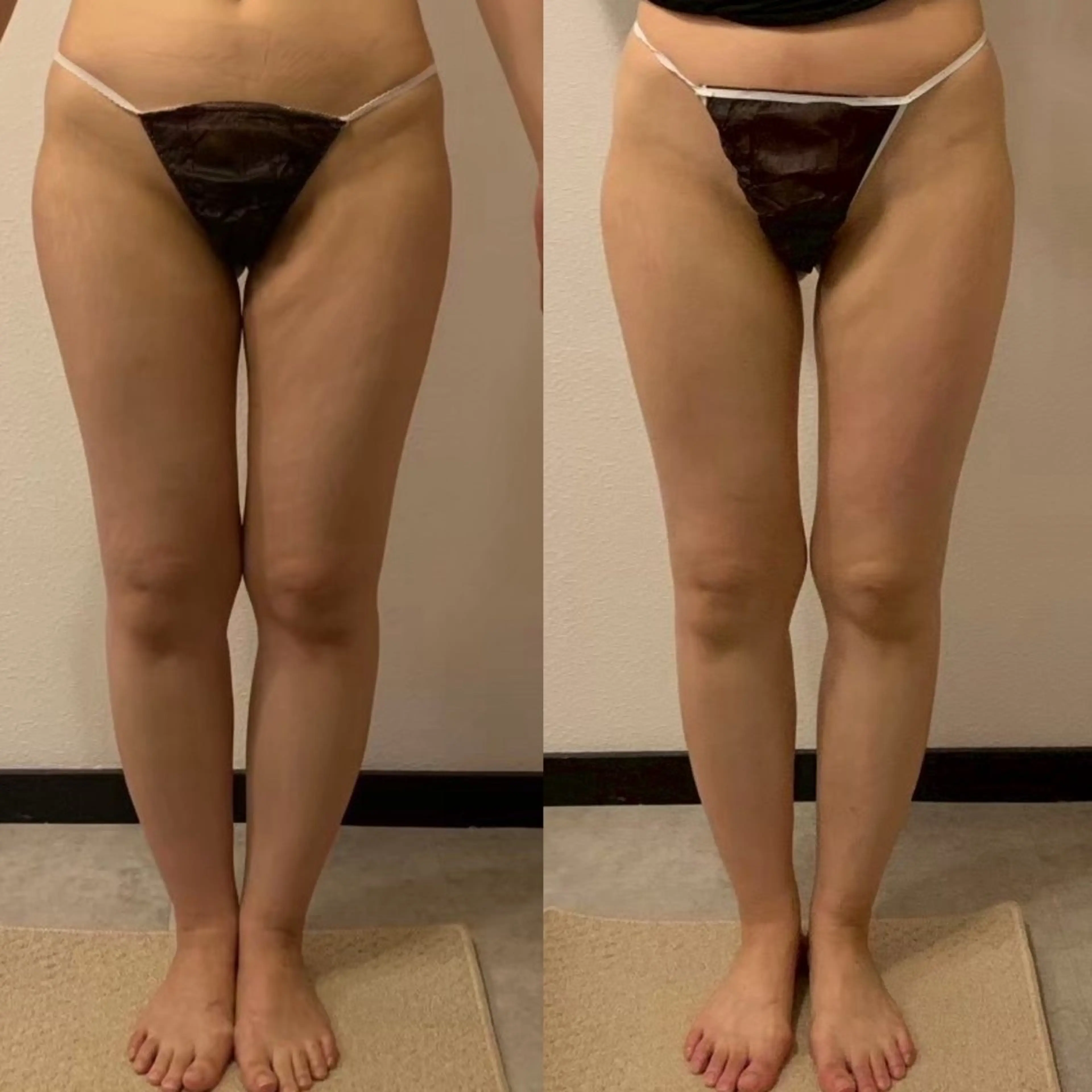 エステ 体重よりも見た目を 変える脚痩せサロンのエステ・リラクイメージ