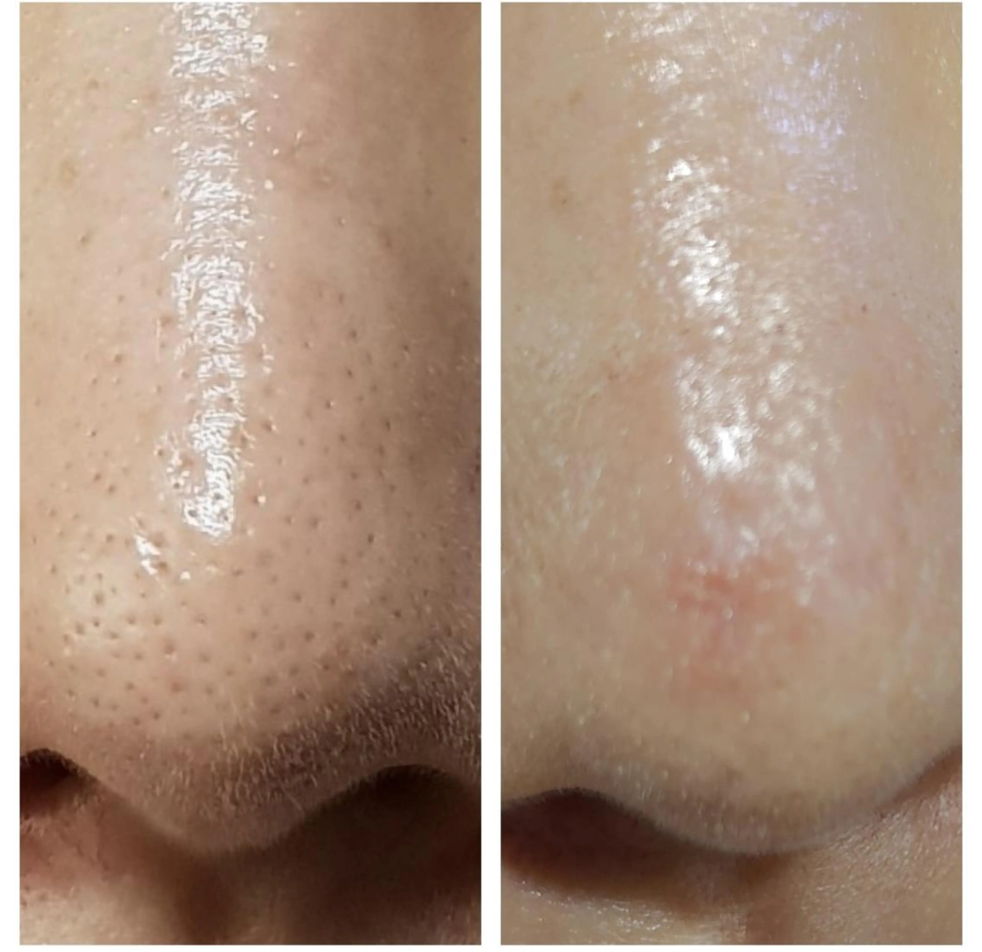 メンズ Epina 千葉店 【エピナ】のエステ・リラクイメージ