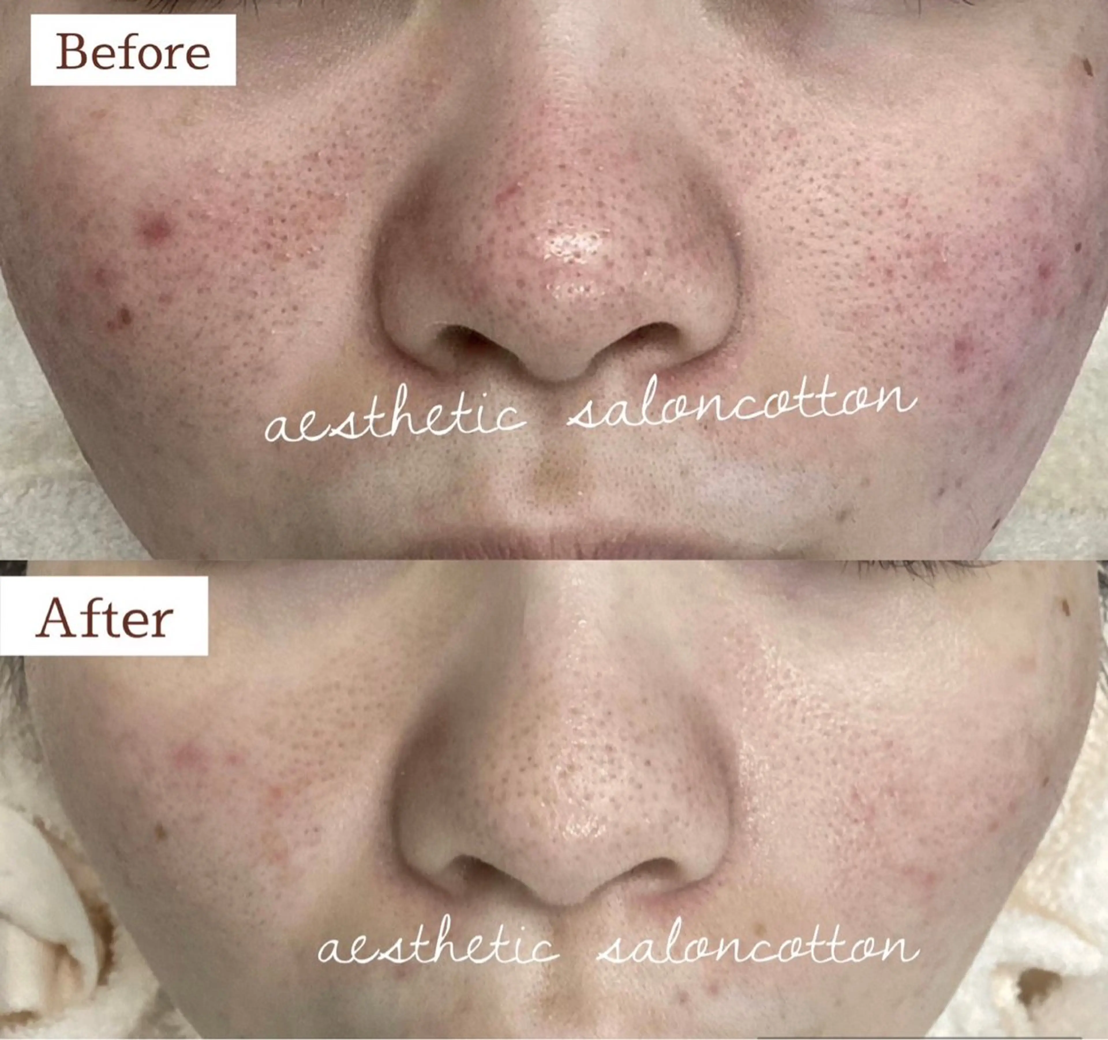 エステ 都度払い 肌質改善専門サロンのエステ・リラクイメージ