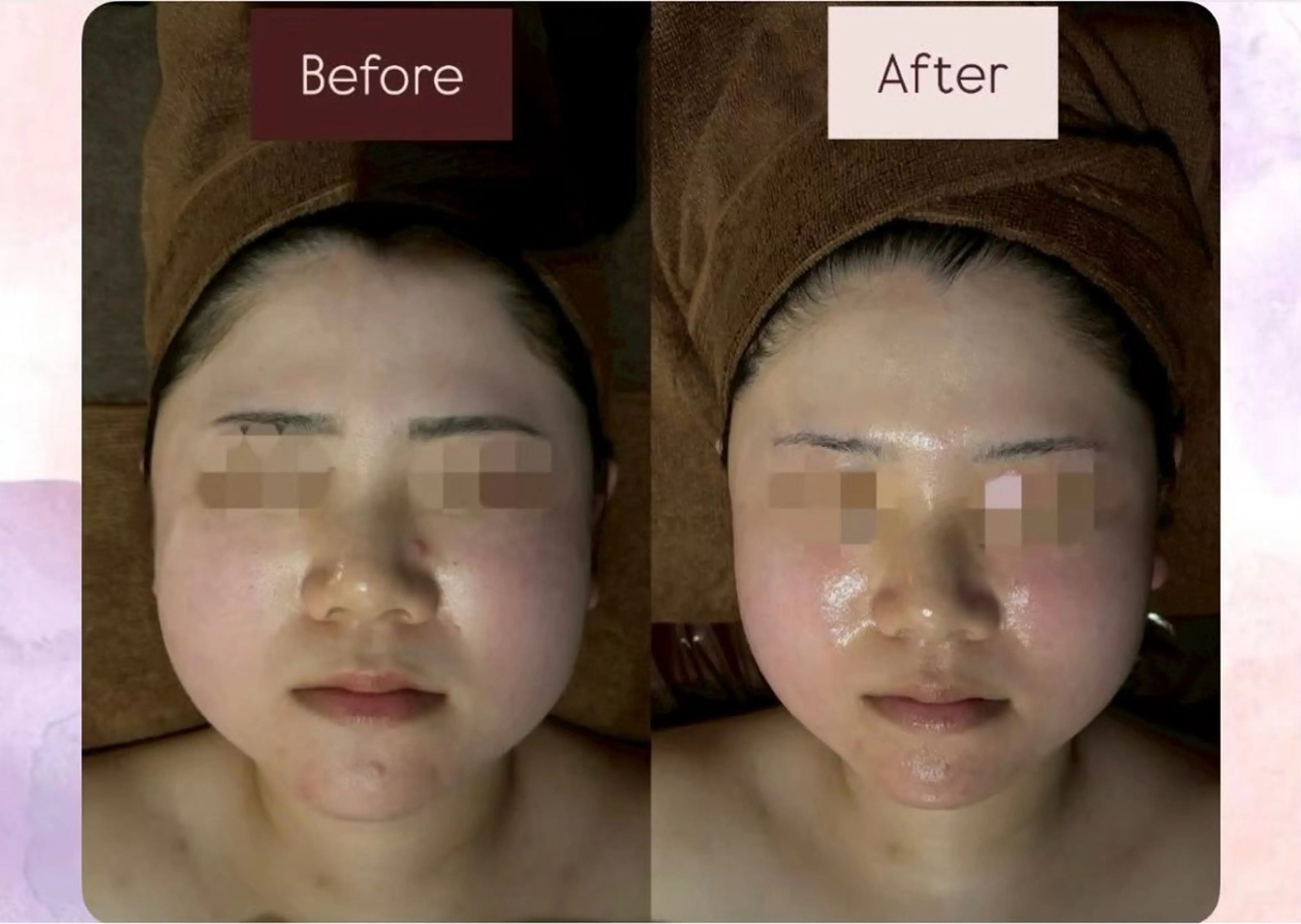 NOEL まるこのエステ・リラクイメージ