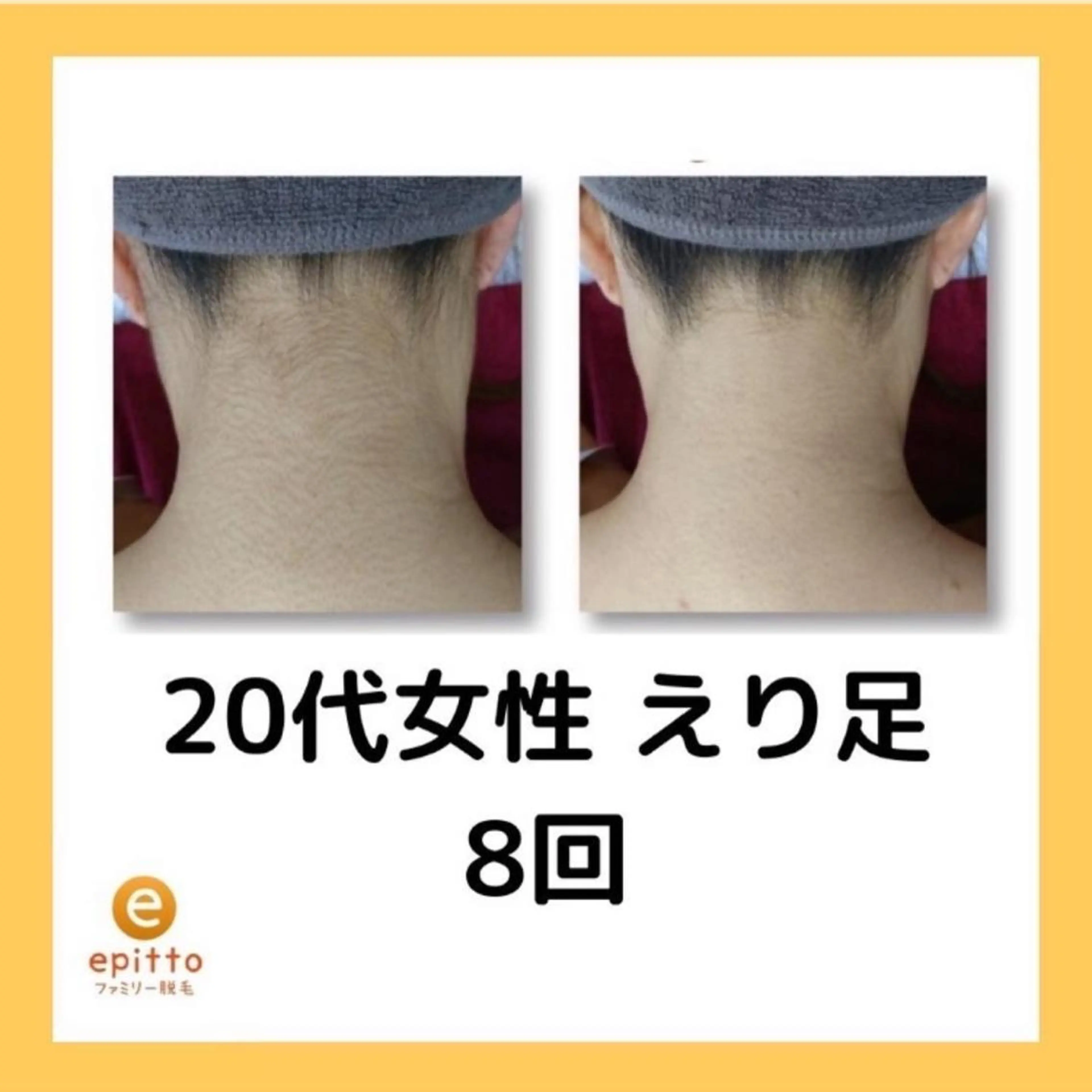 エピット横浜磯子店 大森のエステ・リラクイメージ