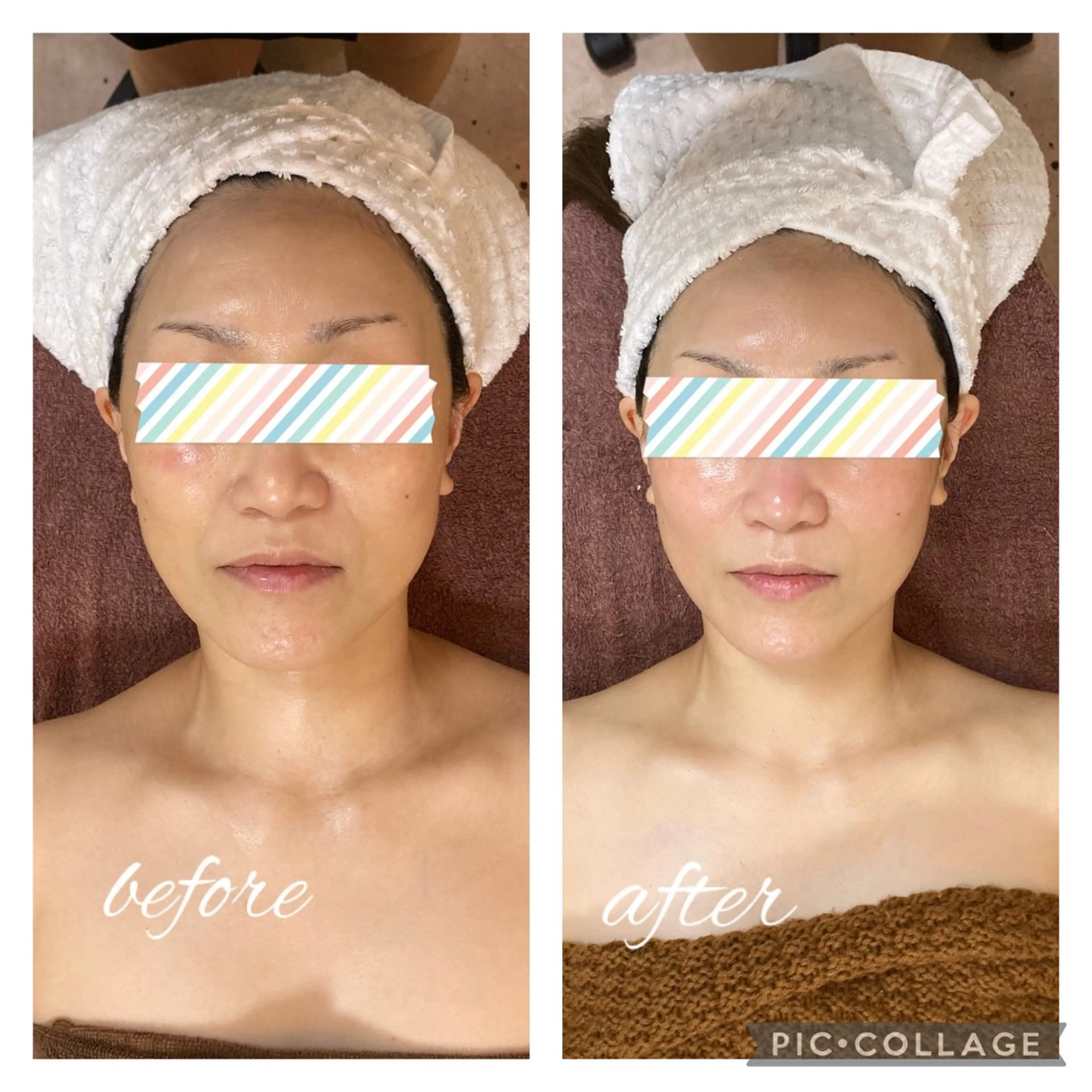 衝撃小顔コース！小顔矯正+美肌フェイシャル＋首デコルテマッサージ！ゴットハンドでうっとりしながらたるみケア！の写真