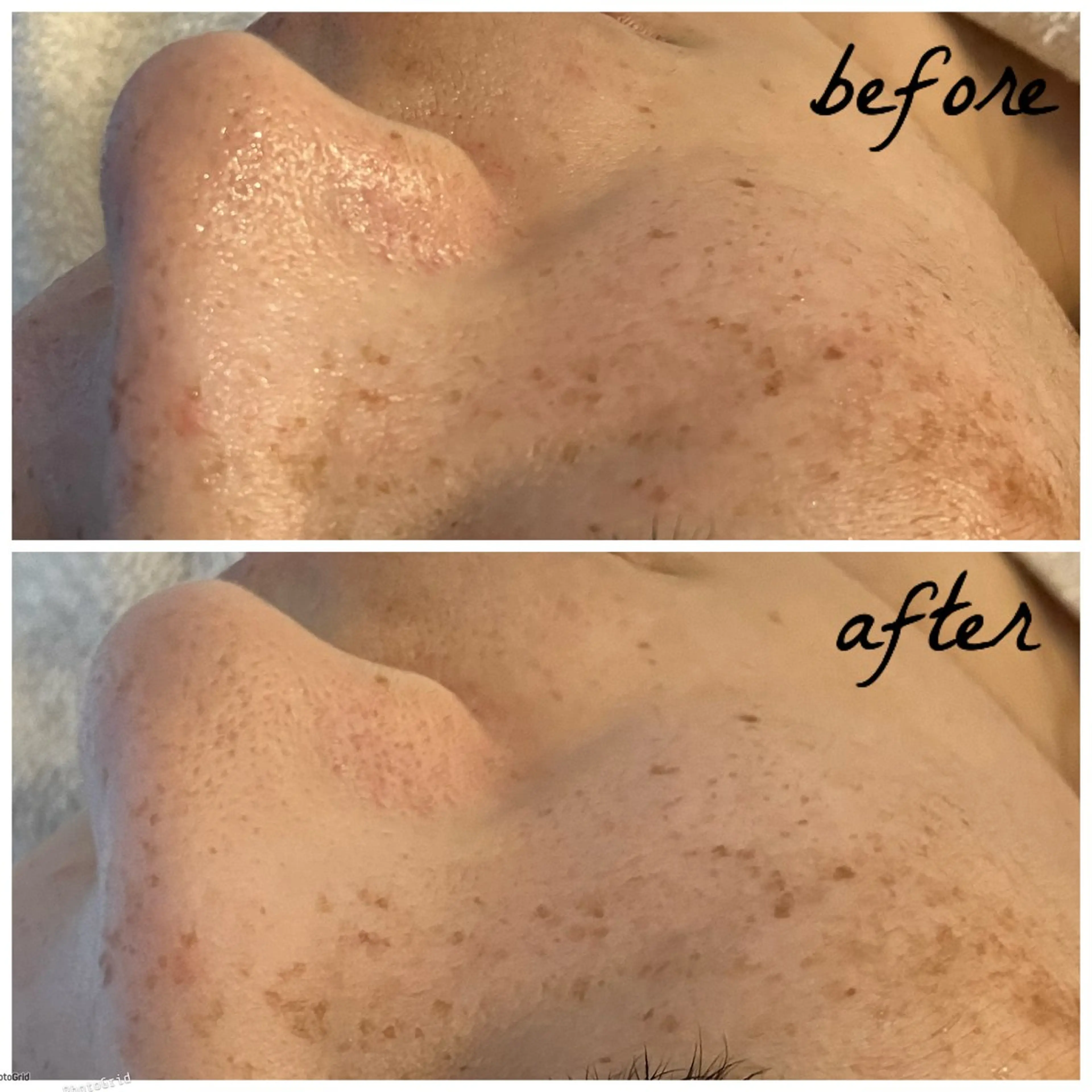 メンズ エステ メナード岐阜市茜部 杉浦のエステ・リラクイメージ