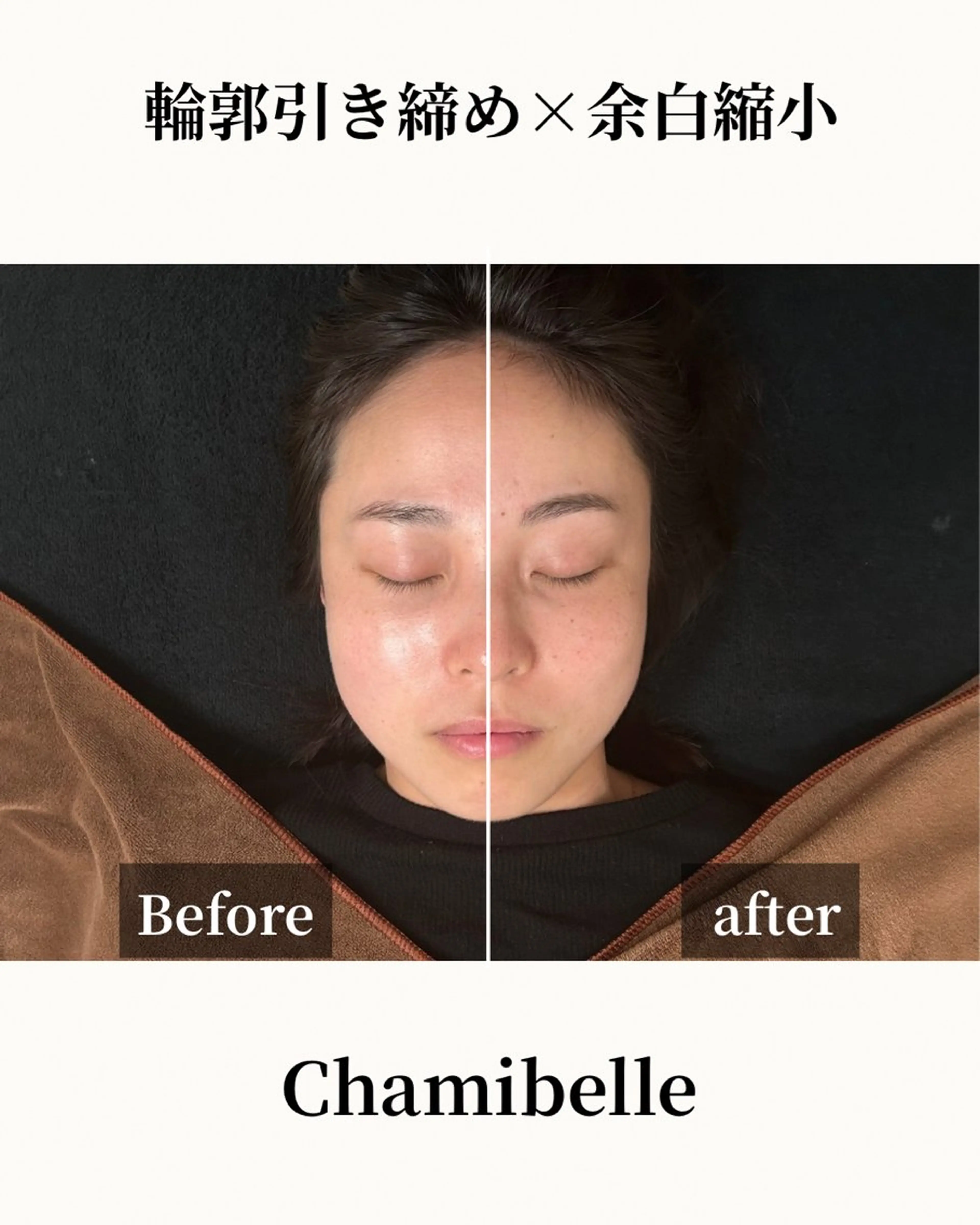 美容鍼灸サロン Chamibelleのエステ・リラクイメージ