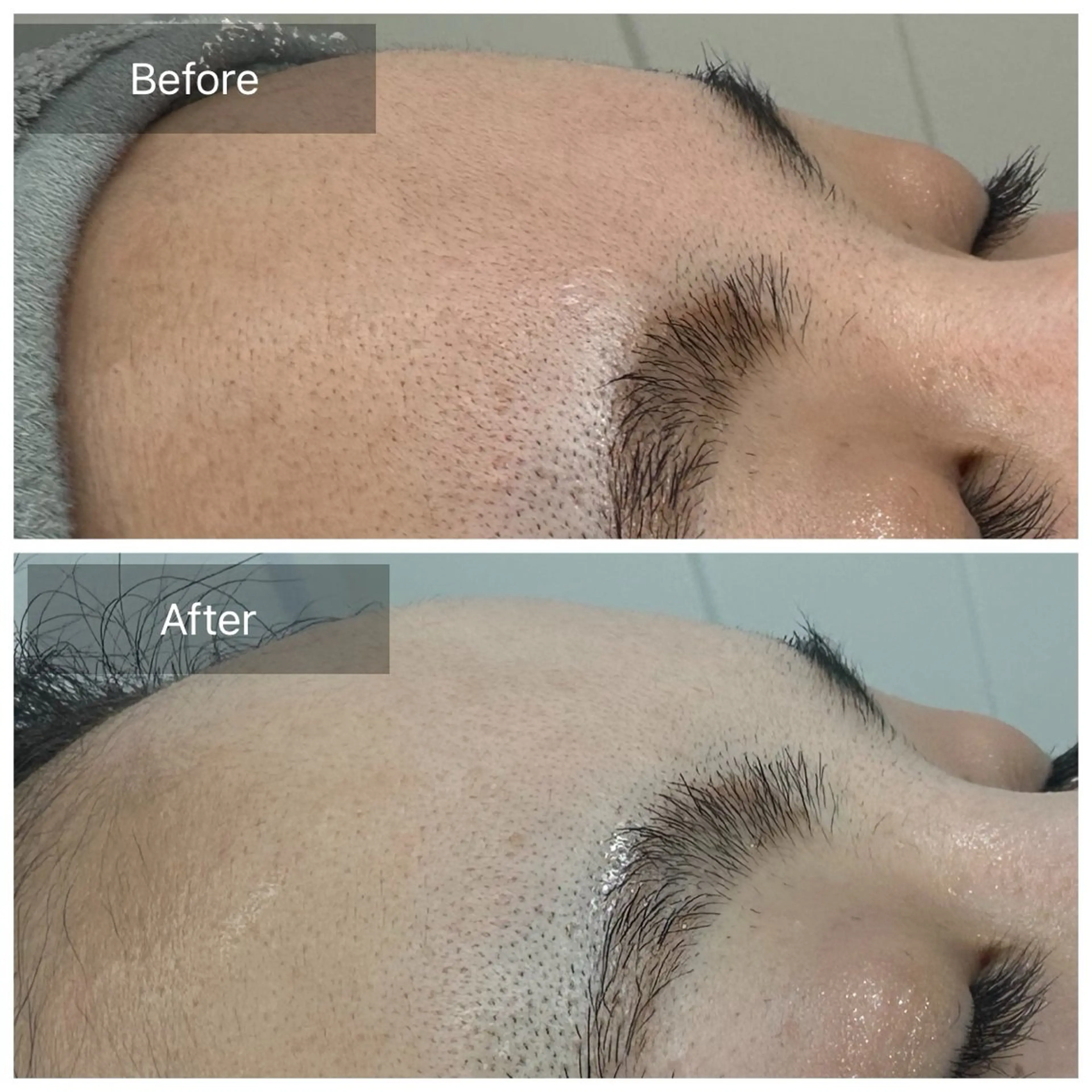 脱毛 トータルしみケア専門 NICA(ニカ)の眉毛・アイブロウイメージ