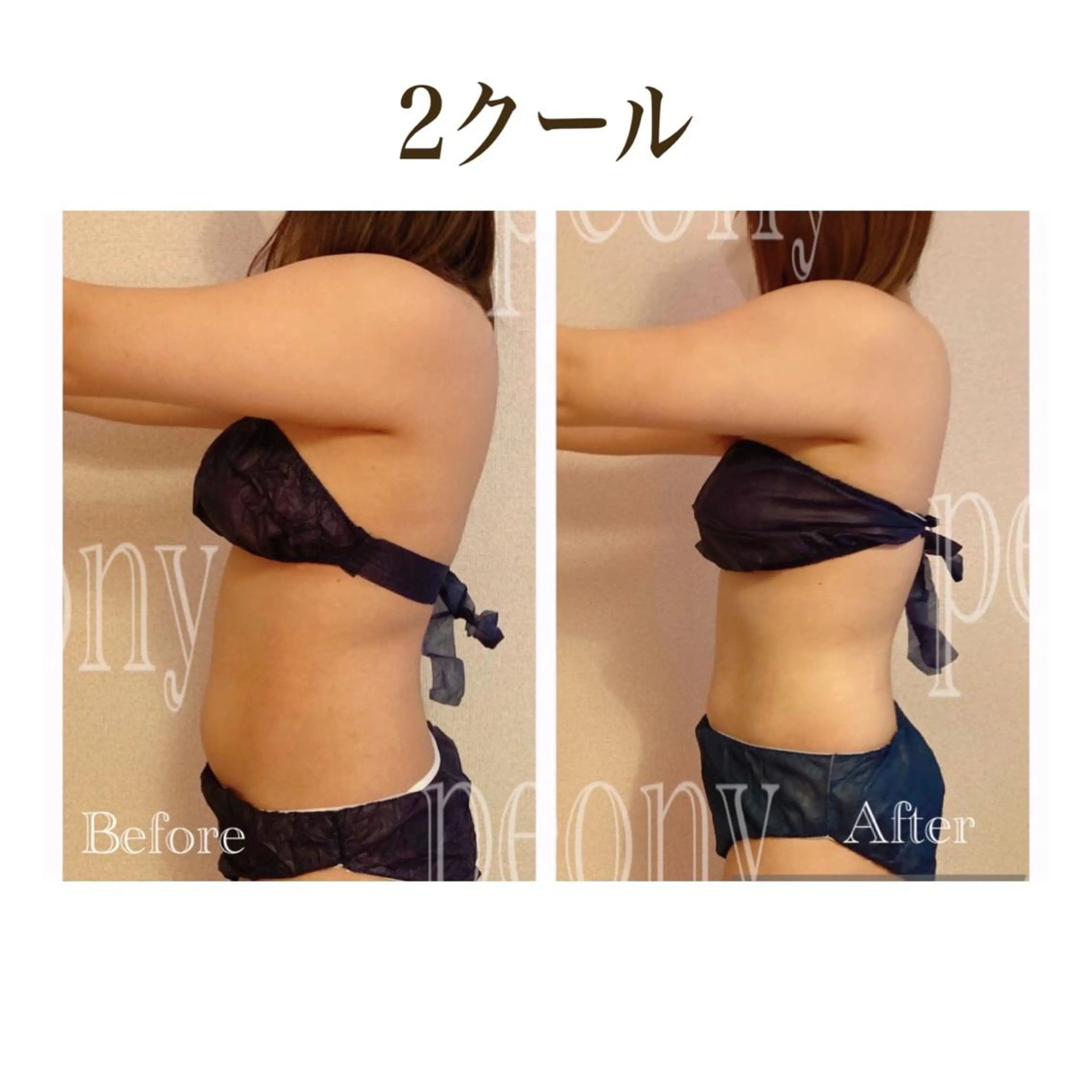 デトックス美容専門 サロンｐｅｏｎｙのエステ・リラクイメージ