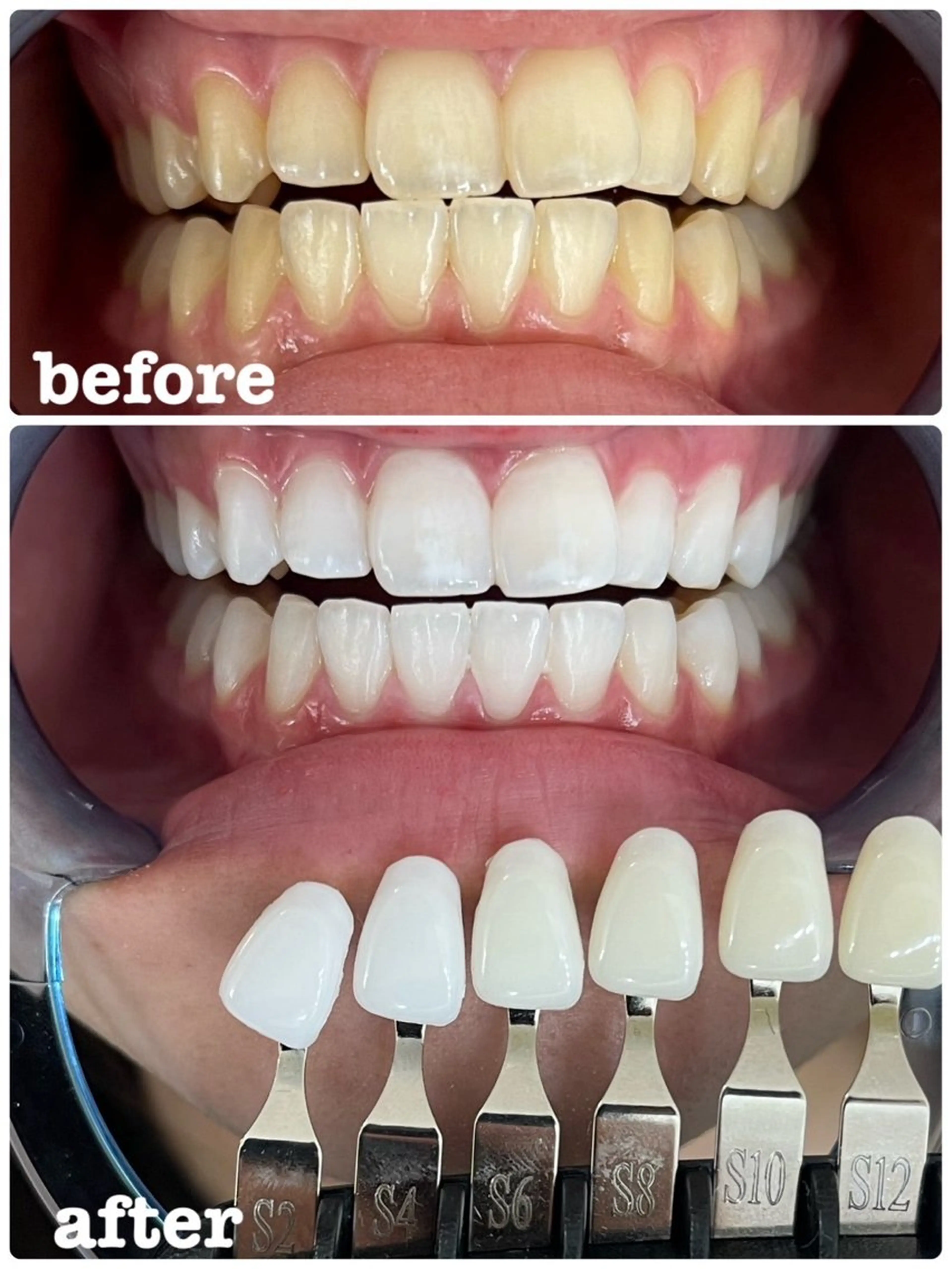 セルフホワイトニング エクシア徳島店マユのその他イメージ