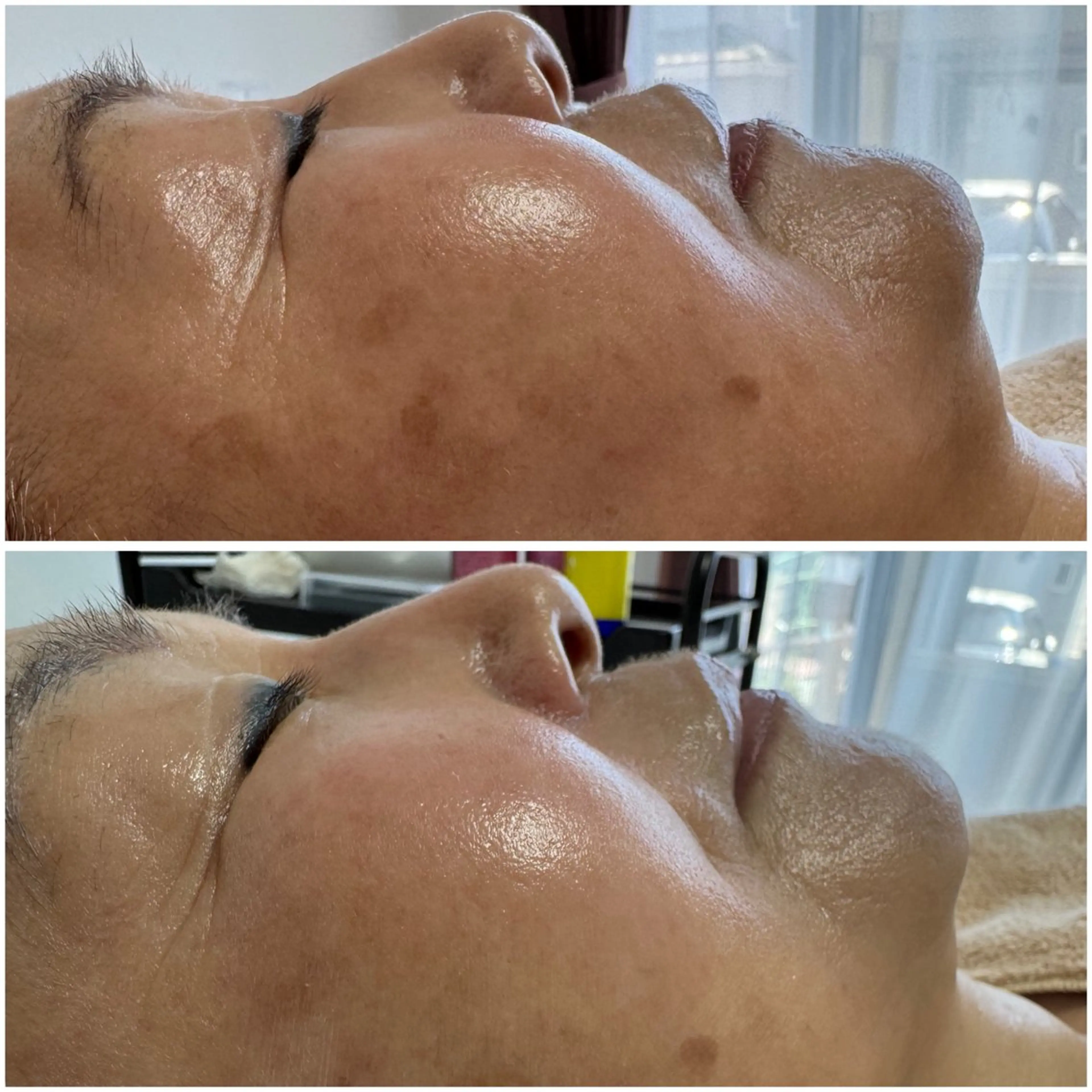 肌質改善サロン Manaririoのエステ・リラクイメージ