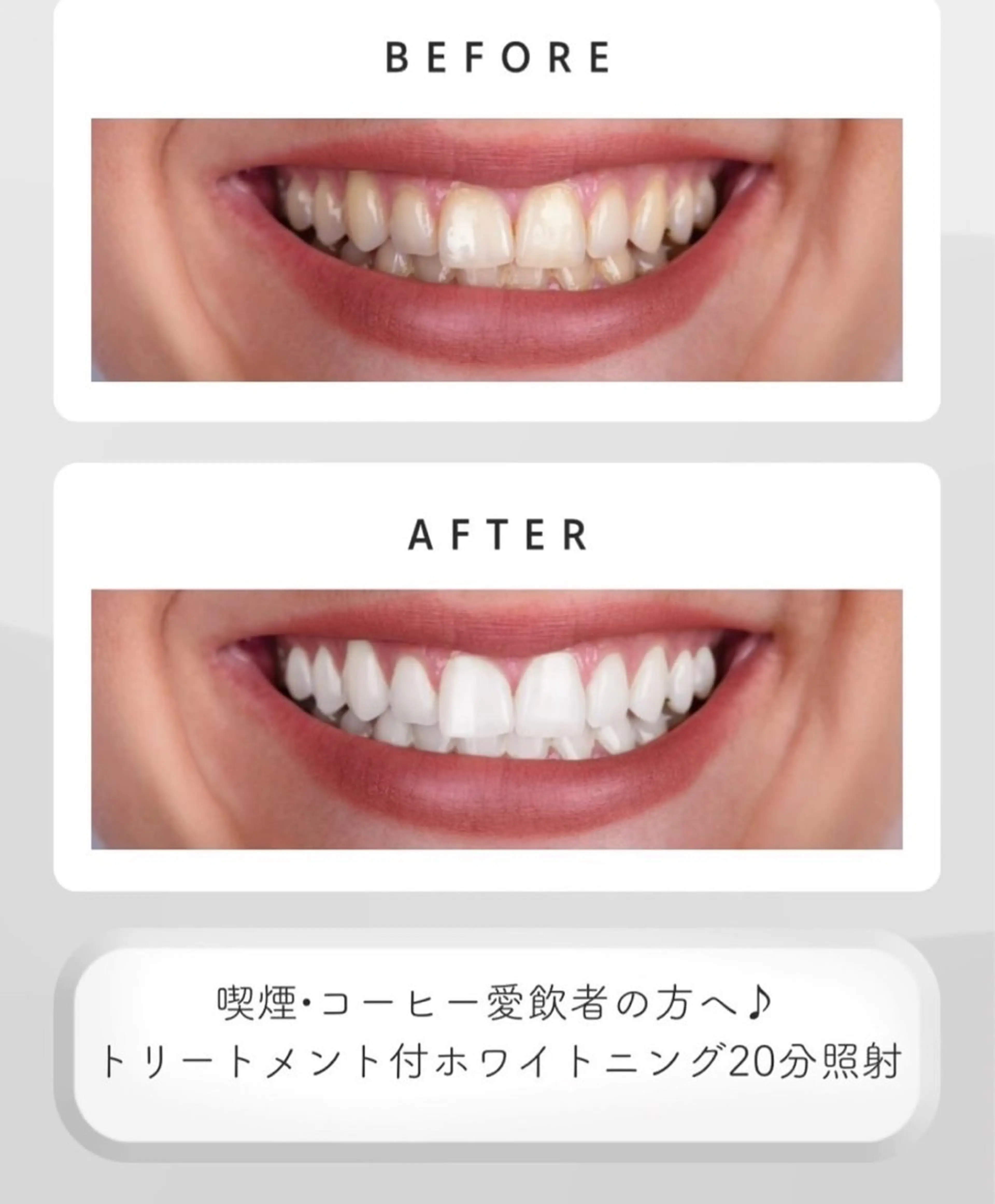 黒田 セルフホワイトニングのその他イメージ