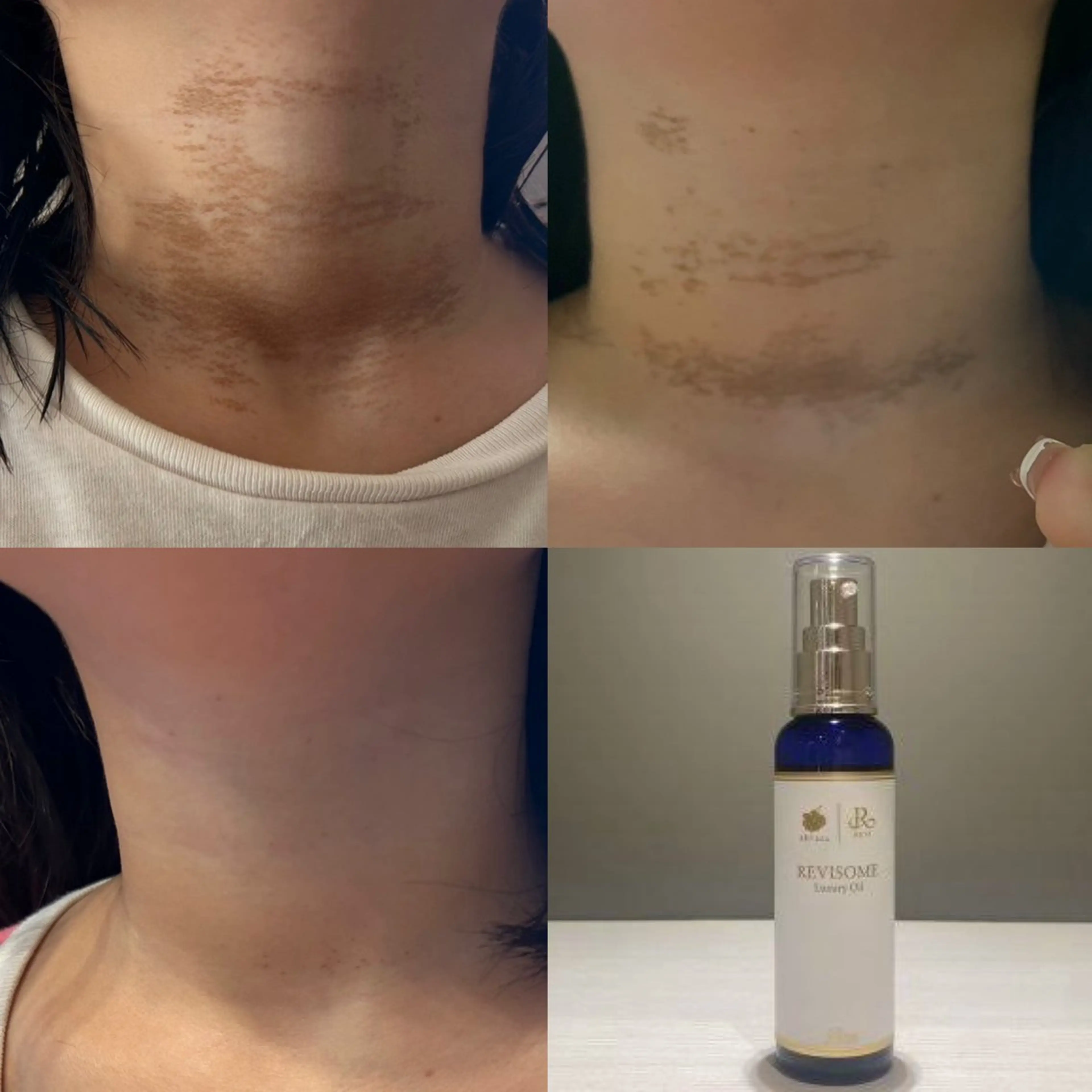 tokyosalon麻布十番所属・ｱﾗﾌｫｰでも20代 の肌になるサロンのエステ・リラクイメージ