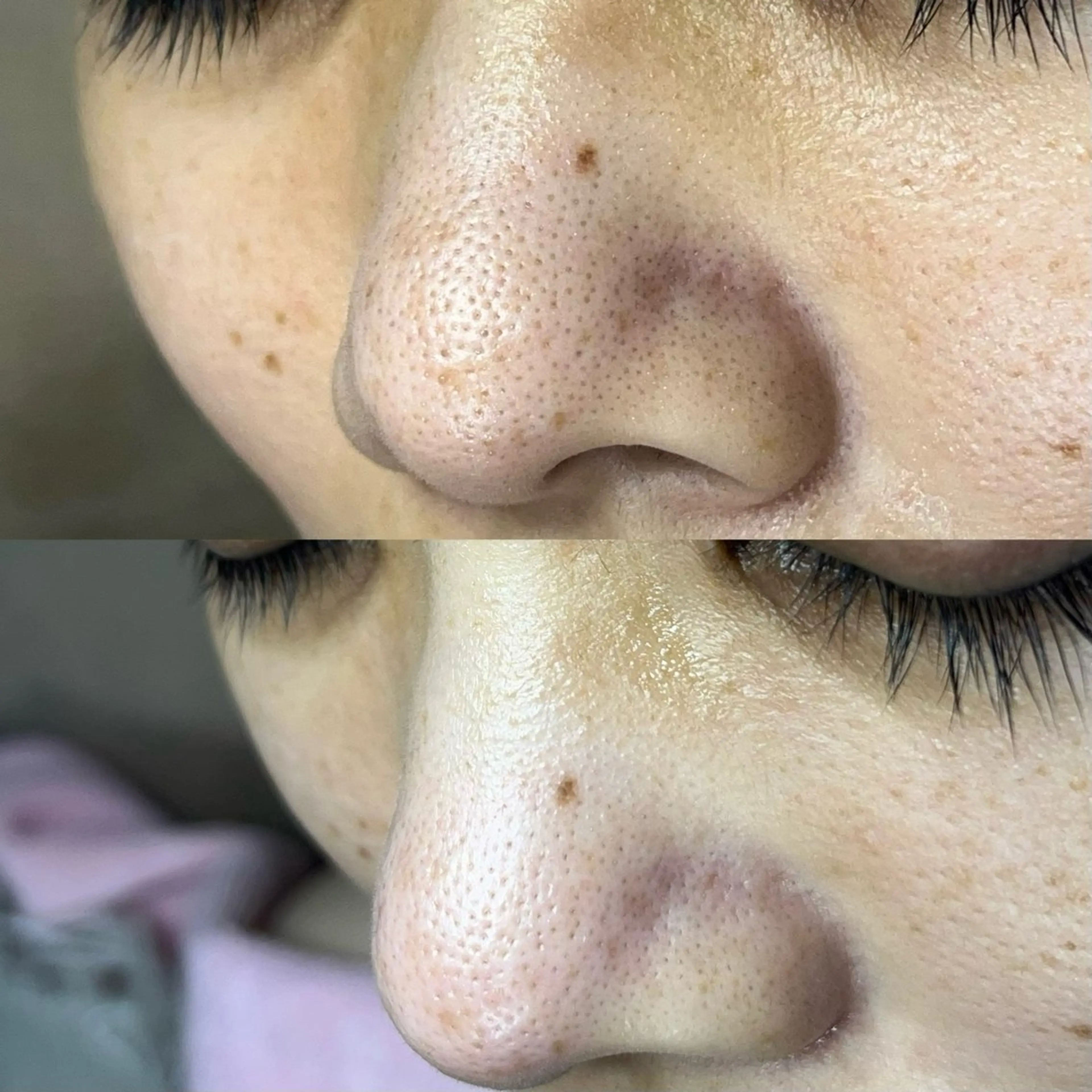 毛穴ケア・ヘッドスパサロンSHINY(シャイニー)所属・毛穴ケア・ヘッドスパ サロンSHINYのエステ・リラクイメージ