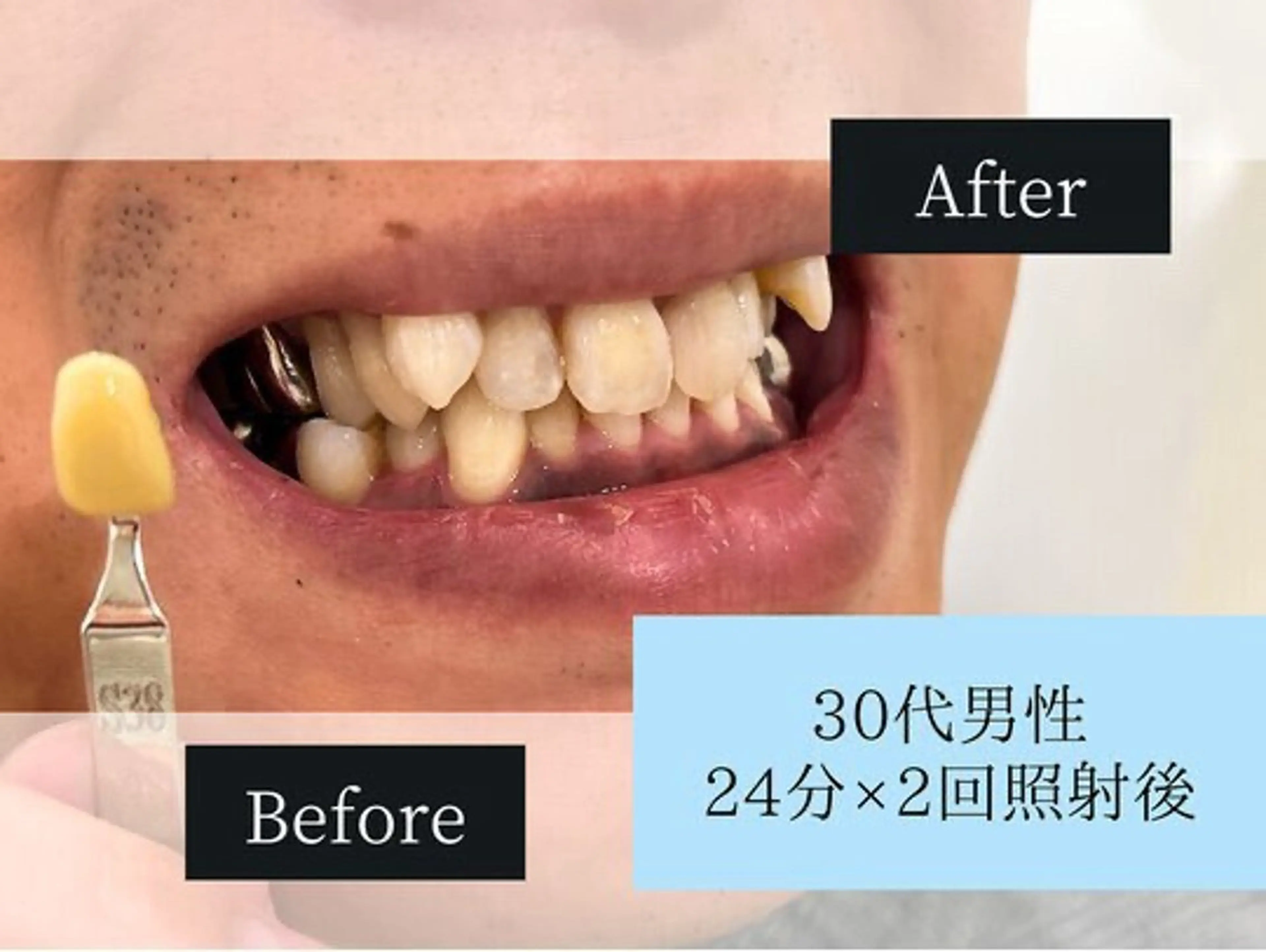 ホワイトニングカフェ原宿店所属・ホワイトニングカフェ 原宿店のエステ・リラクイメージ