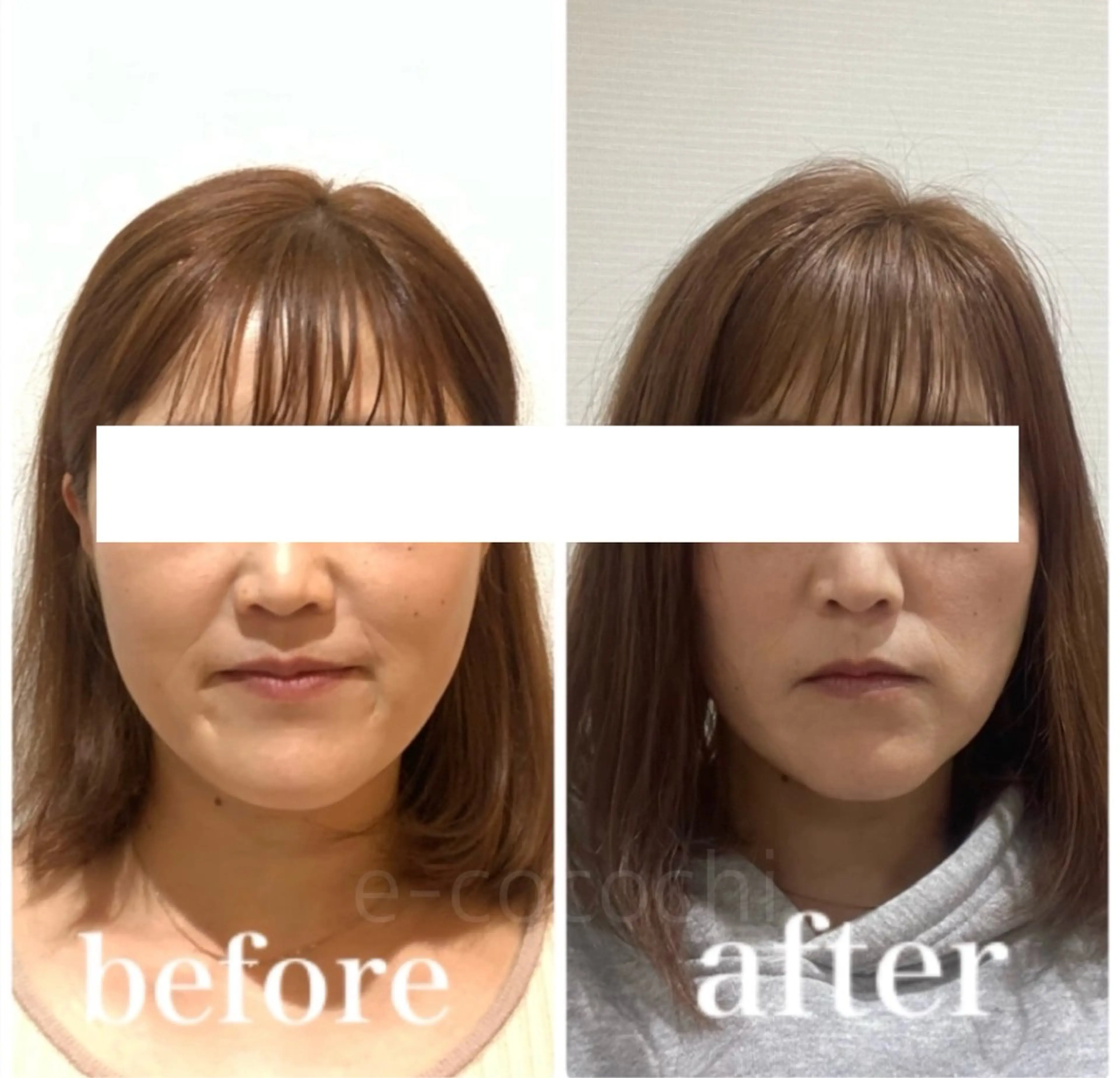 エステ リラク 小顔と ヘッドスパのお店のエステ・リラクイメージ