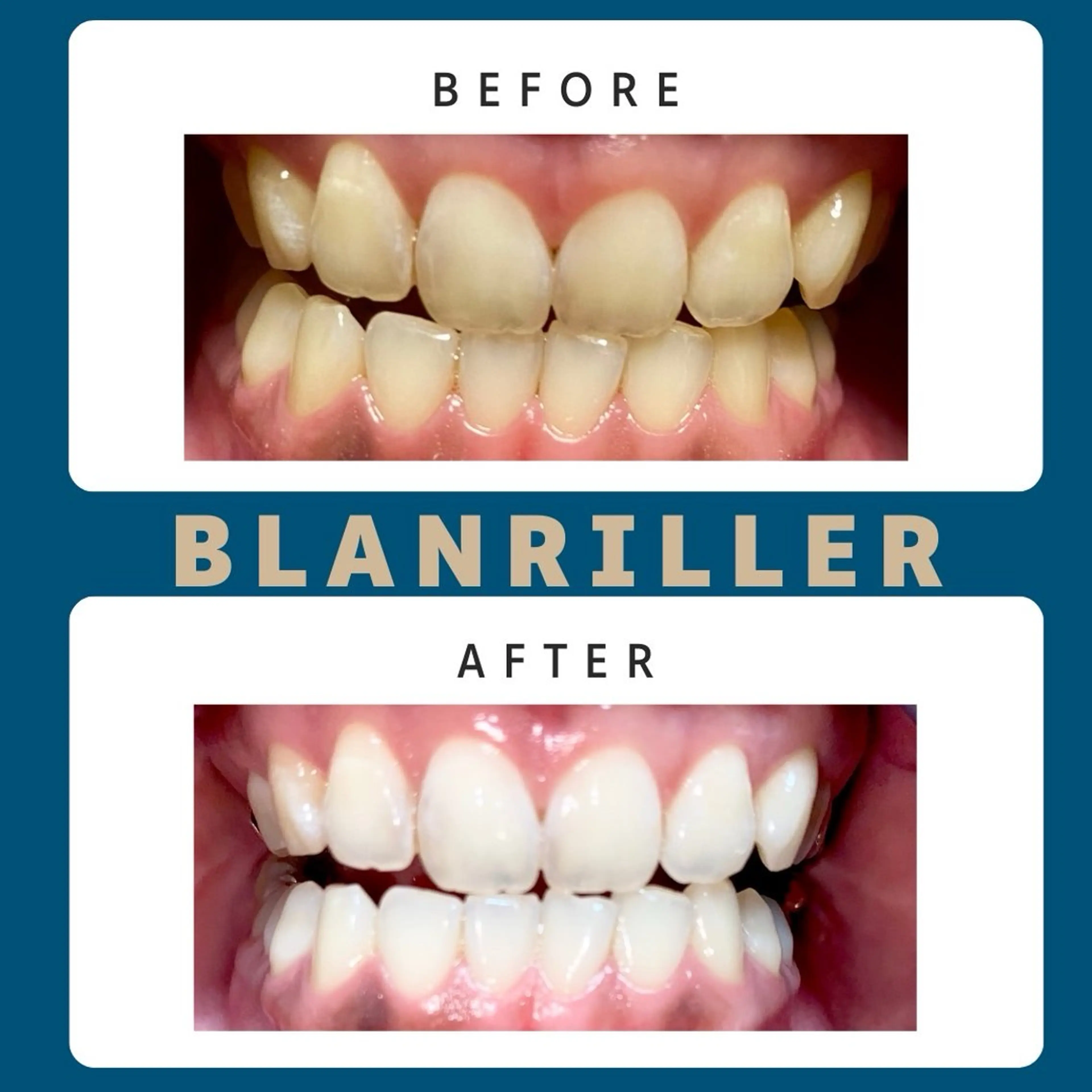 BLANRILLER所属・ホワイトニングサロン ブランリエ阿倍野店のその他イメージ