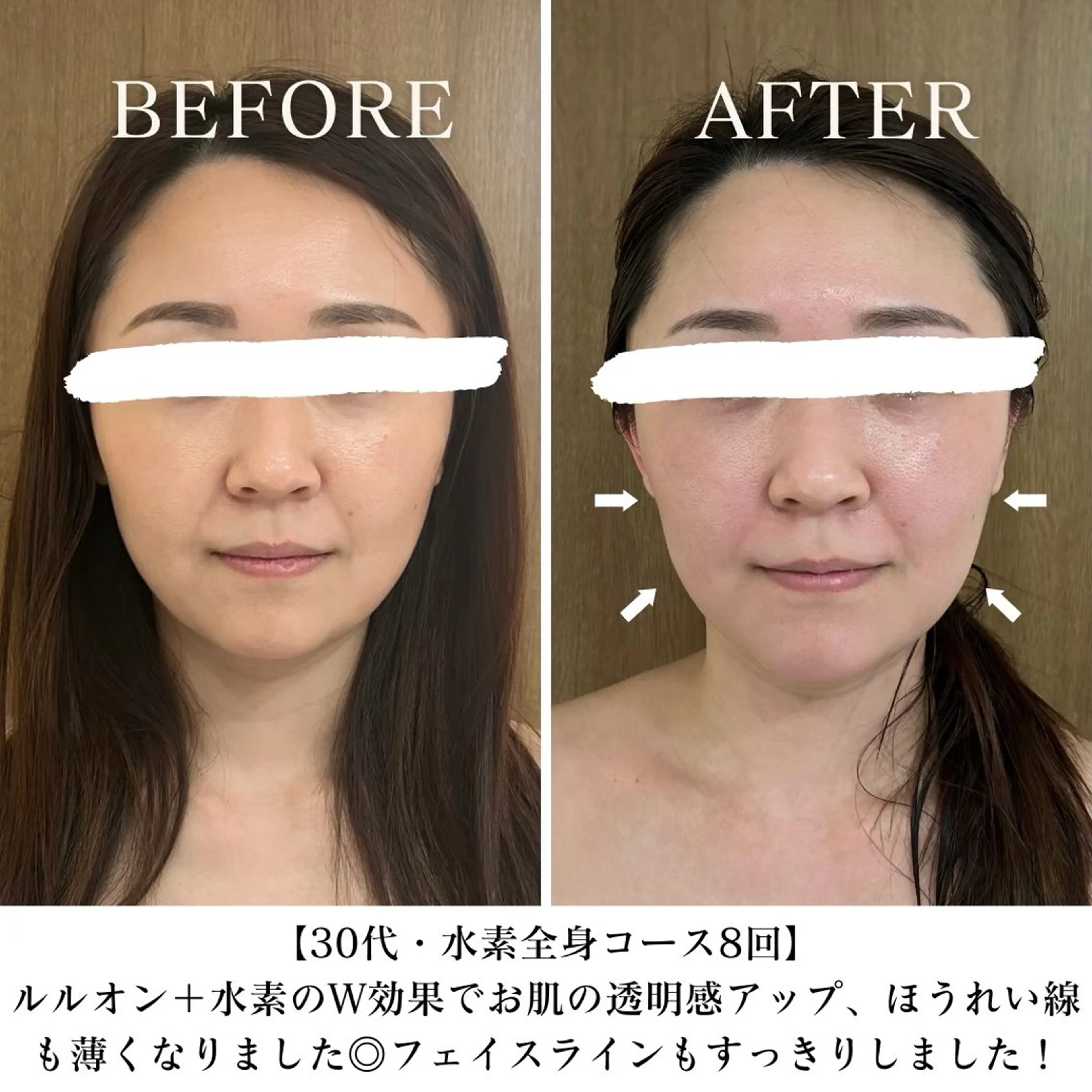 【西荻窪】本格痩身 最新型よもぎ蒸しのエステ・リラクイメージ