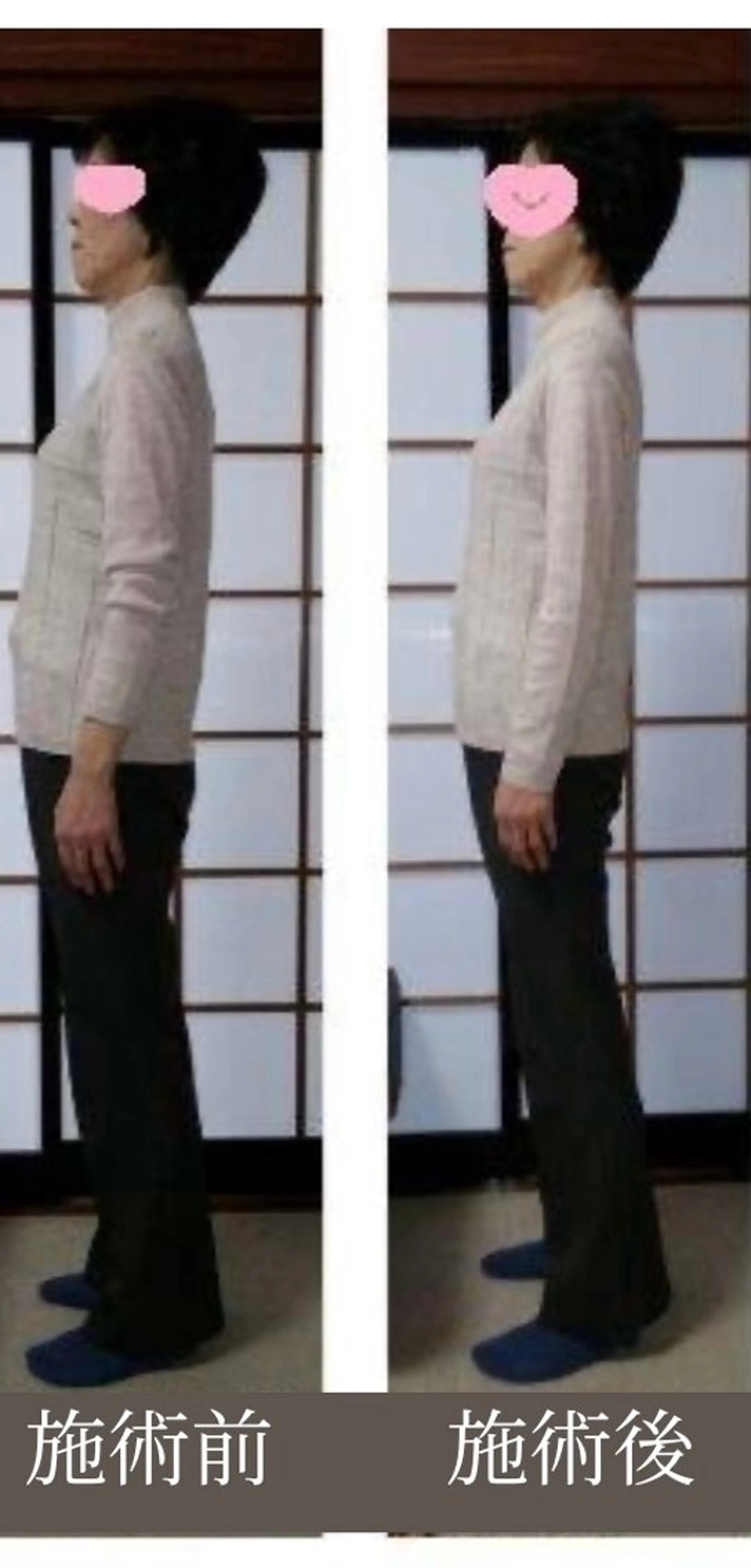 山嵜 まりこのその他イメージ