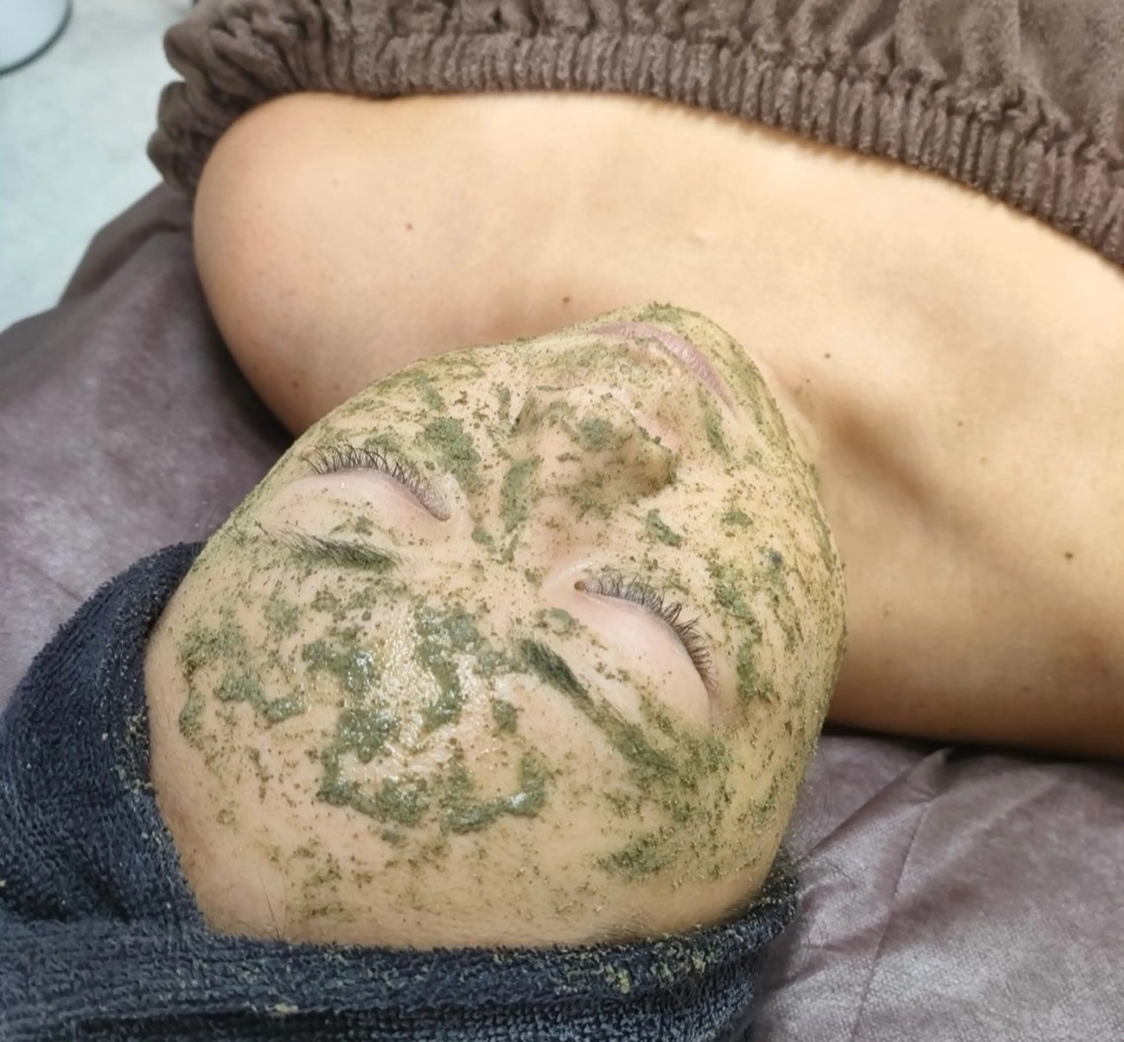 REVI陶肌トリートメント バーブピーリングの写真