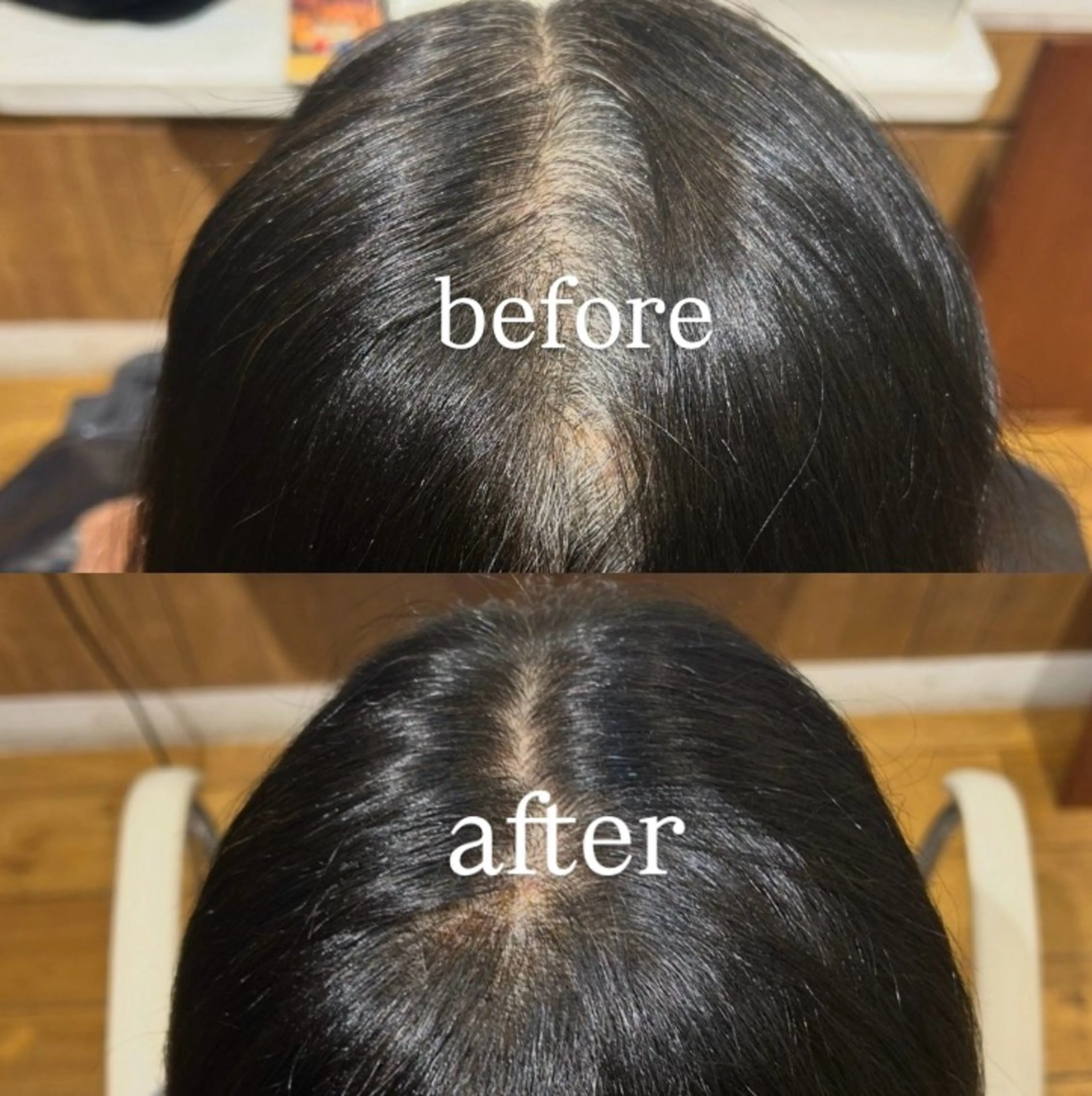 カラー 根本 琴子のヘアスタイル