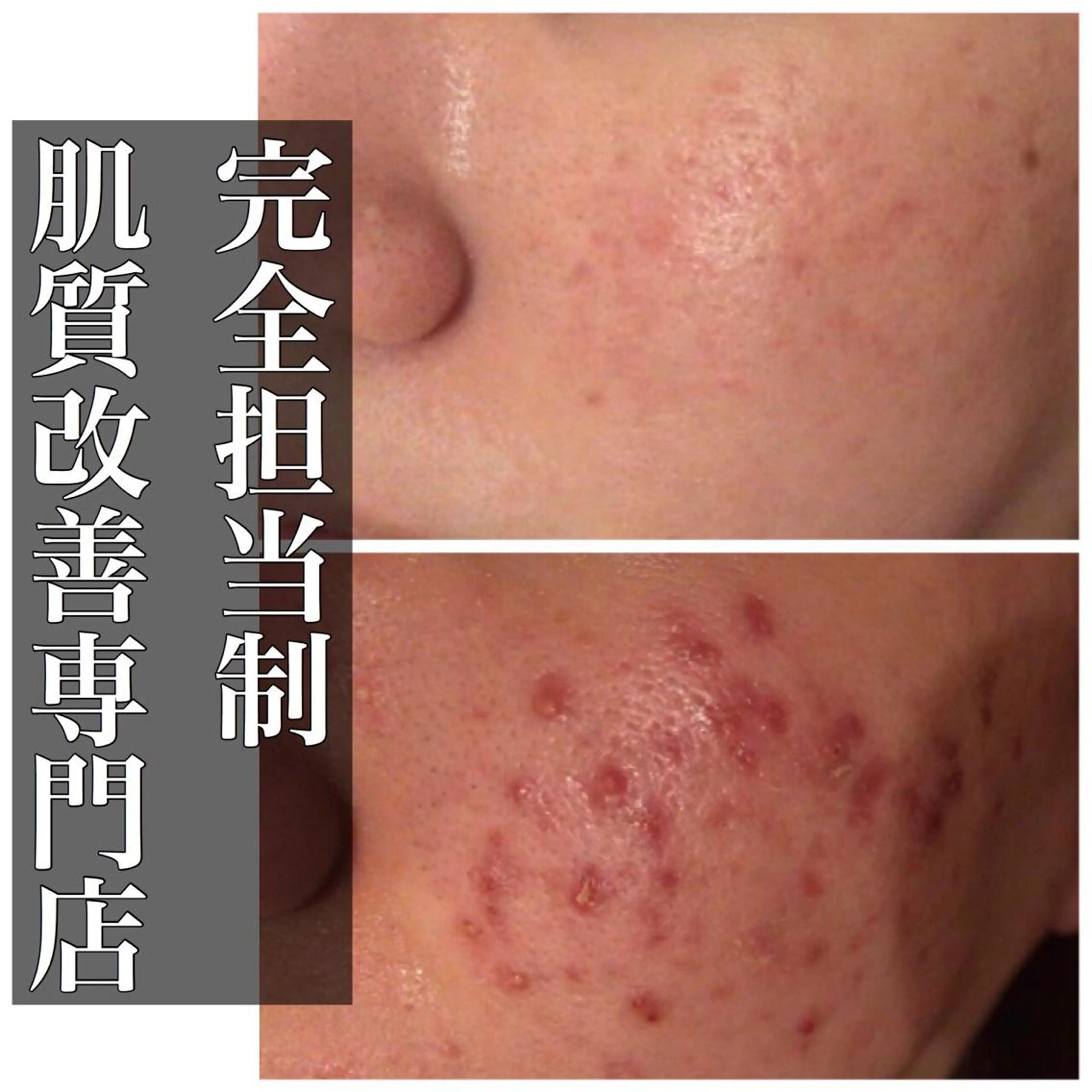 ミディアム カラー パーマ ヘアアレンジ メンズ キッズ ネイル マツエク・マツパ エステ リラク ニキビ・肌質改善専門 ♡人生が変わるサロンのエステ・リラクイメージ