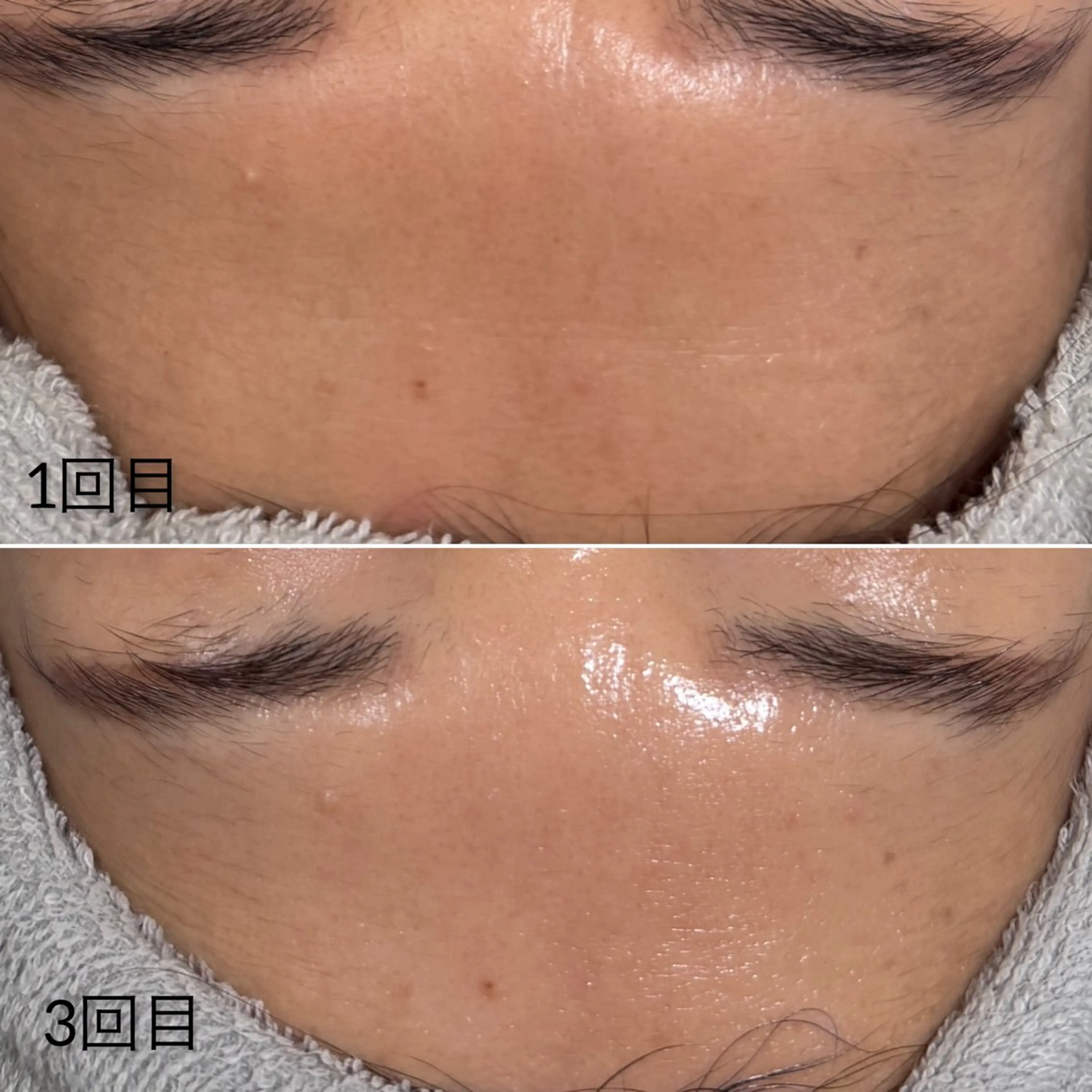 その他 Éclat de Belle🫧白玉肌のその他イメージ