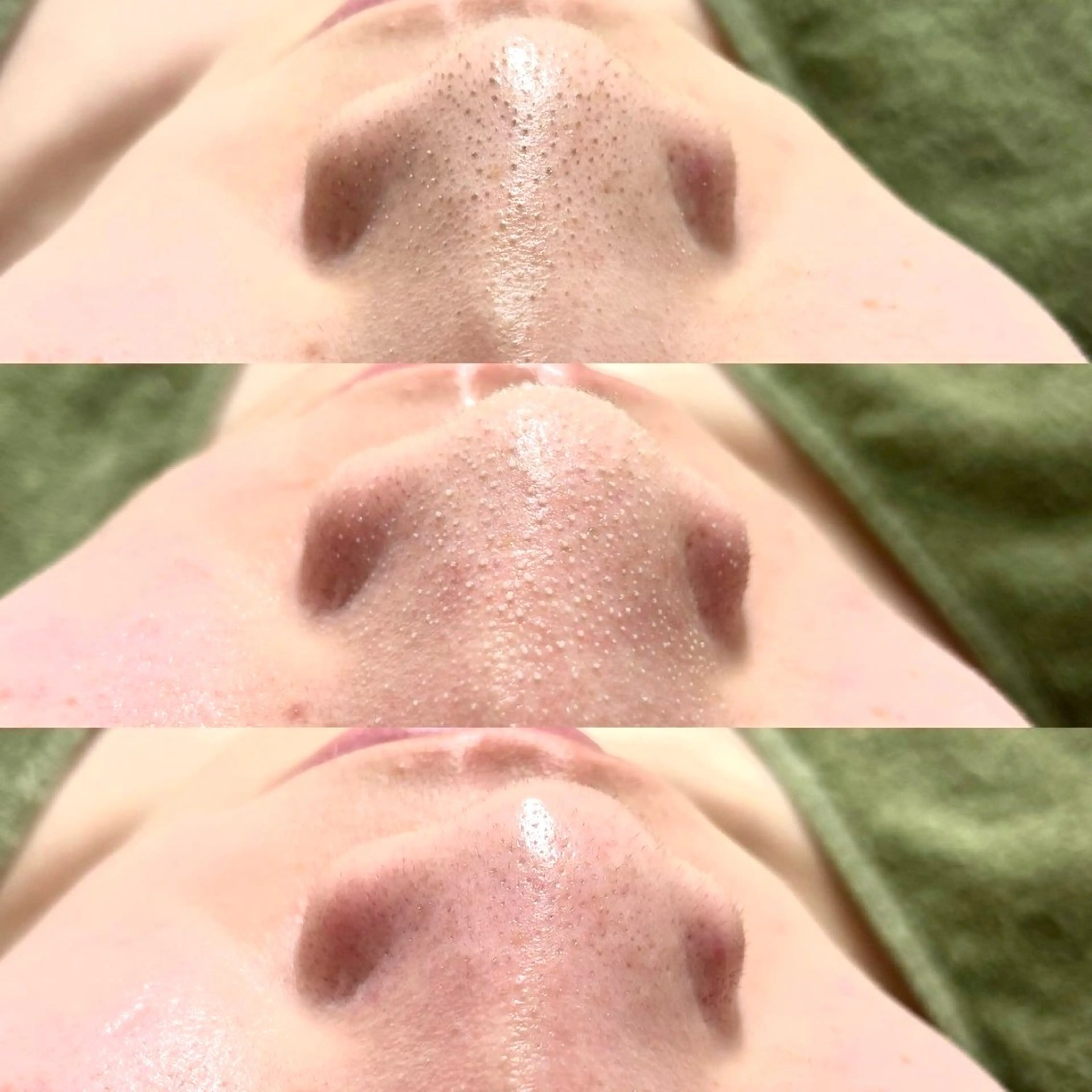 エステ フェイシャル/脱毛 ジョアアンジェ小夷のエステ・リラクイメージ