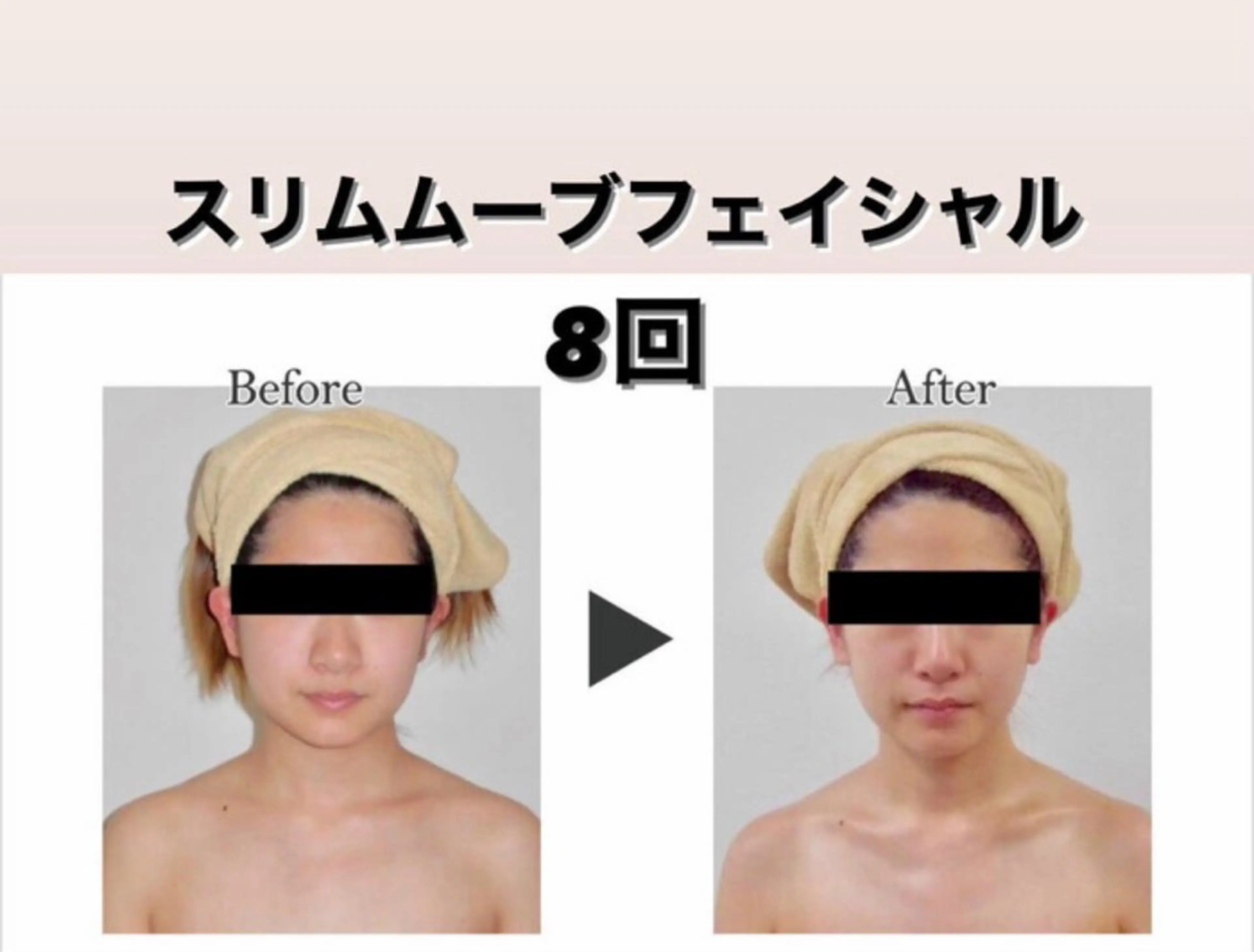 エステ エルモサ痩身脱毛 西八王子店のエステ・リラクイメージ