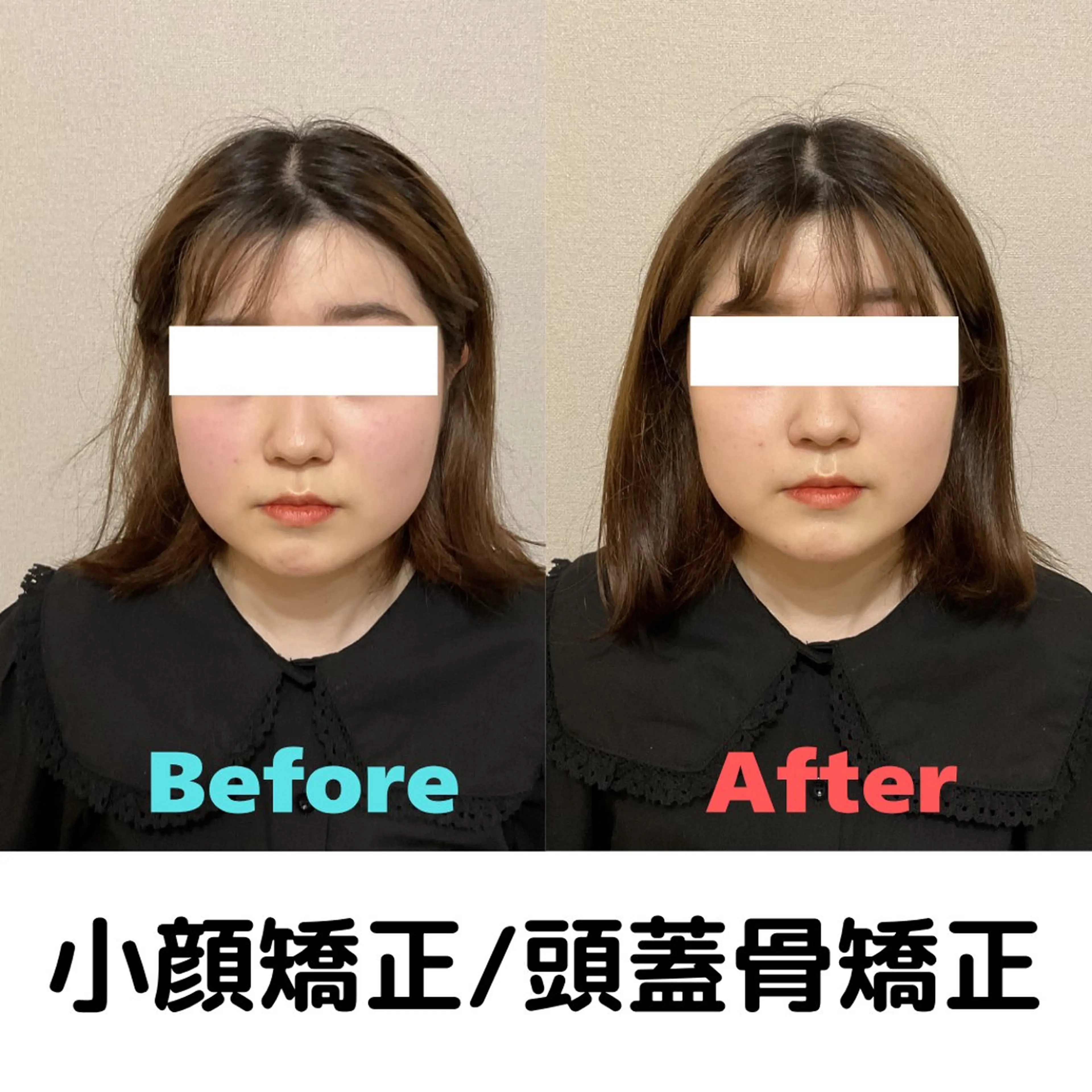 エステ リラク 美容鍼×小顔×整体× ブライダル 大阪梅田のエステ・リラクイメージ