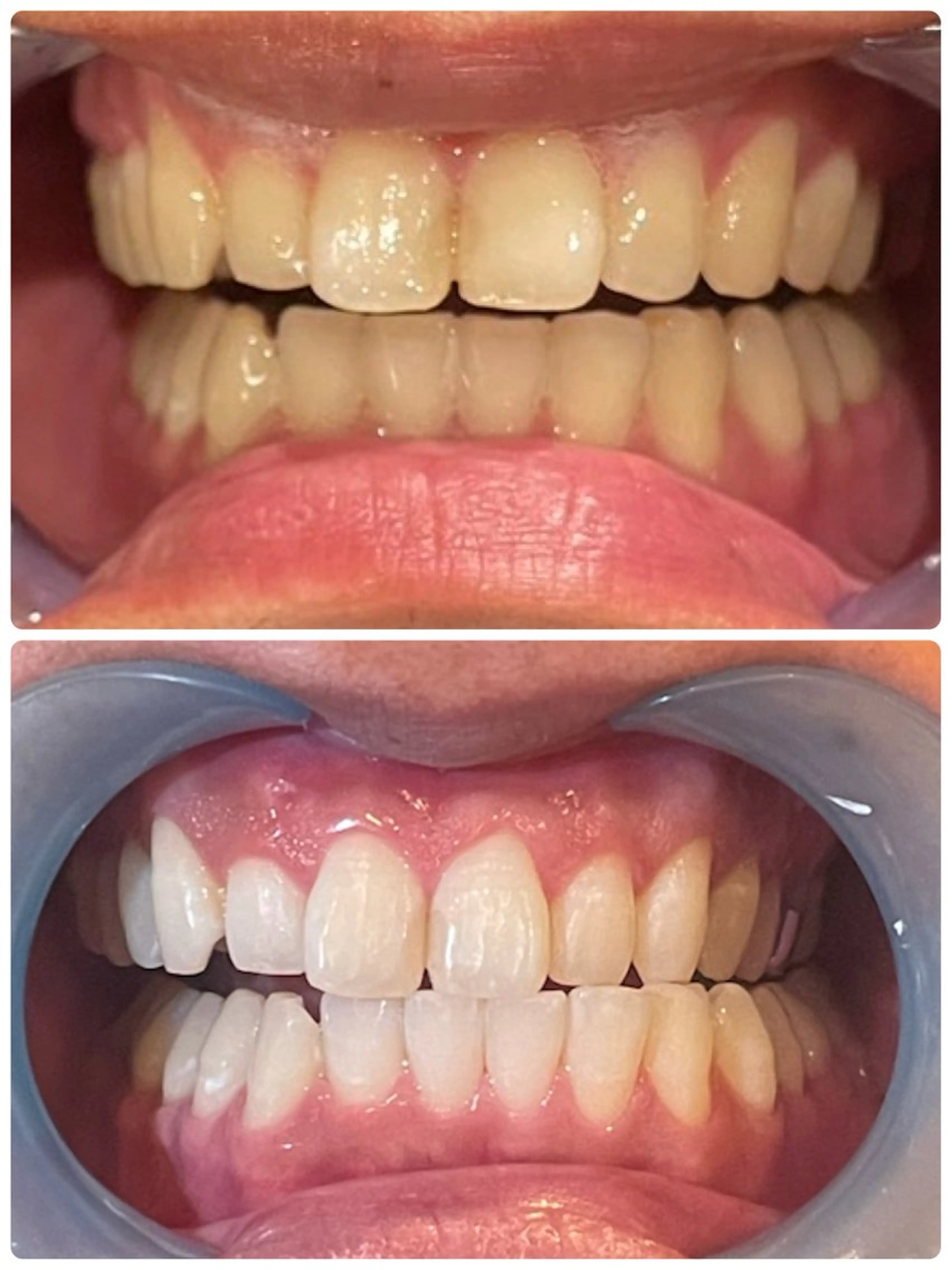 美人スイッチdiet スーパージェクションのその他イメージ