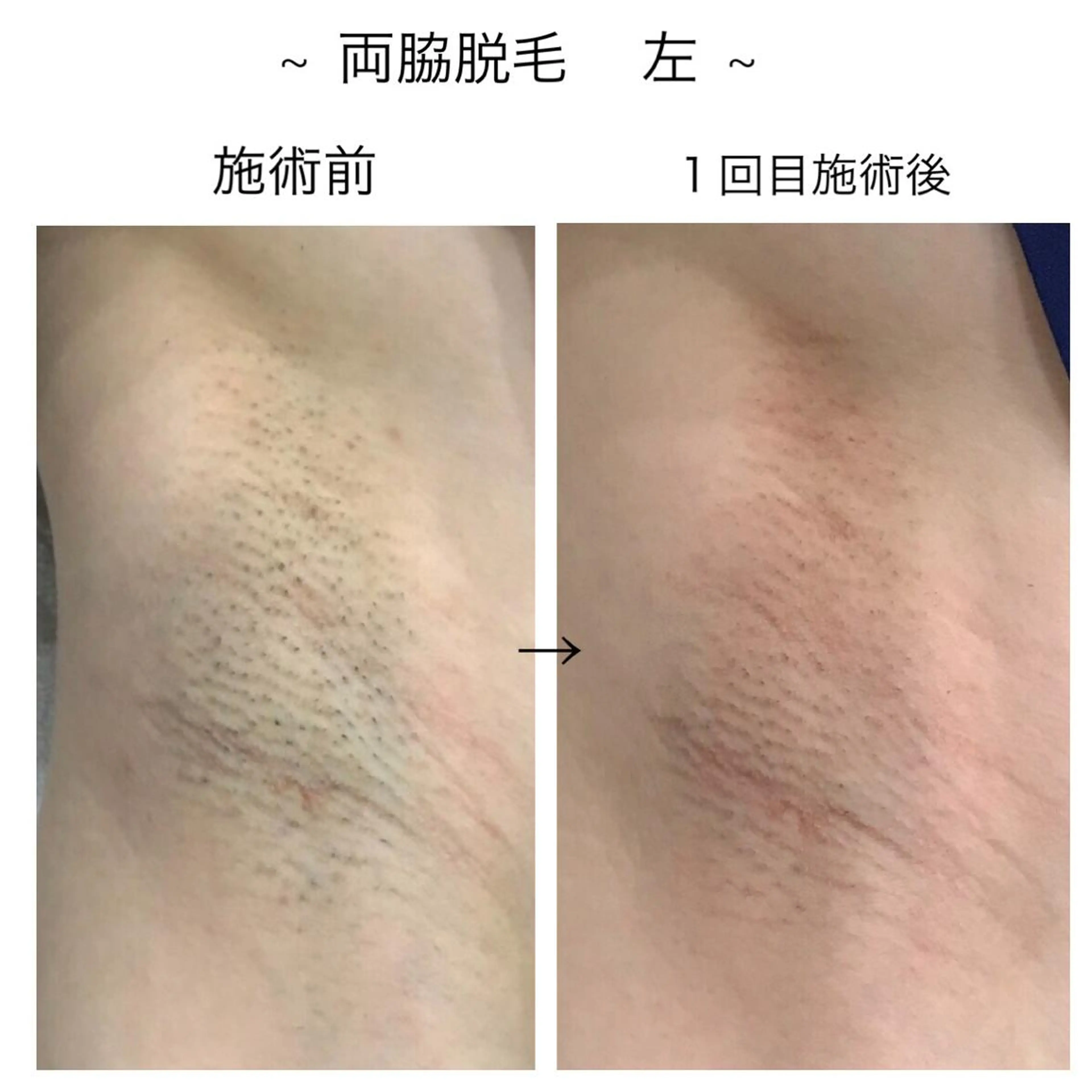 ビューティー ミロワールのエステ・リラクイメージ