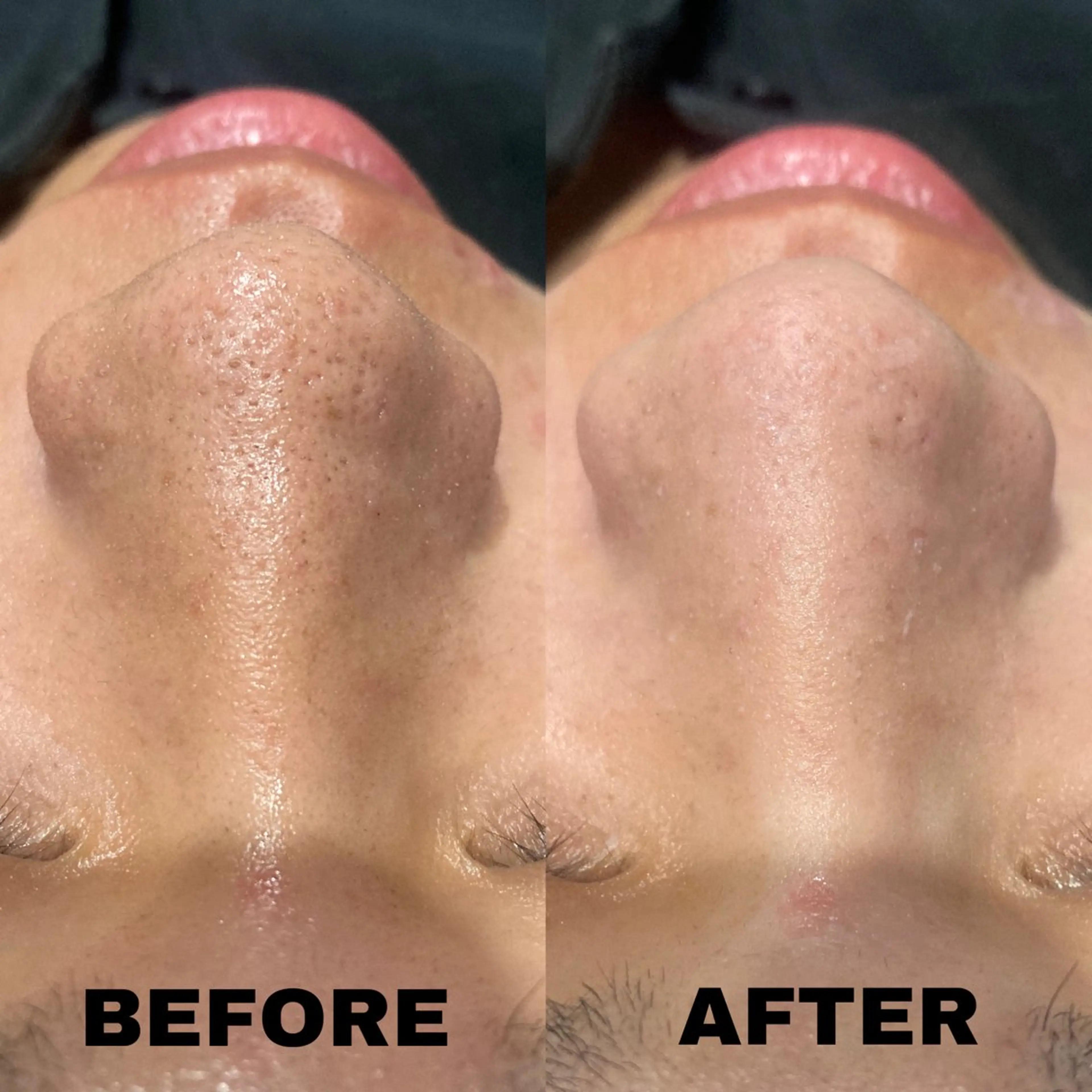 エステ リラク NANIOAFU [なんば店］のその他イメージ