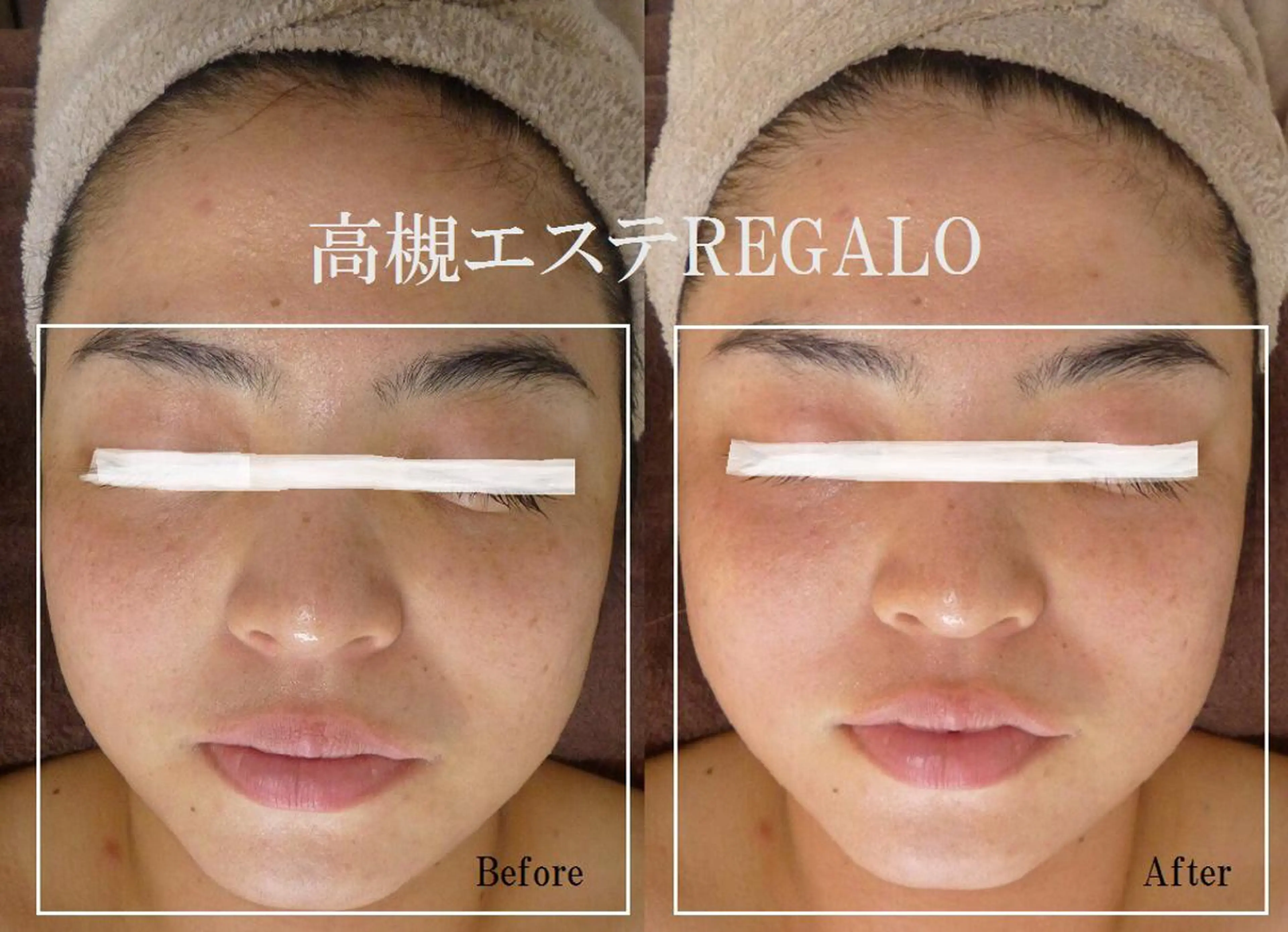 エステ REGALO所属・矢野 さやかのエステ・リラクイメージ