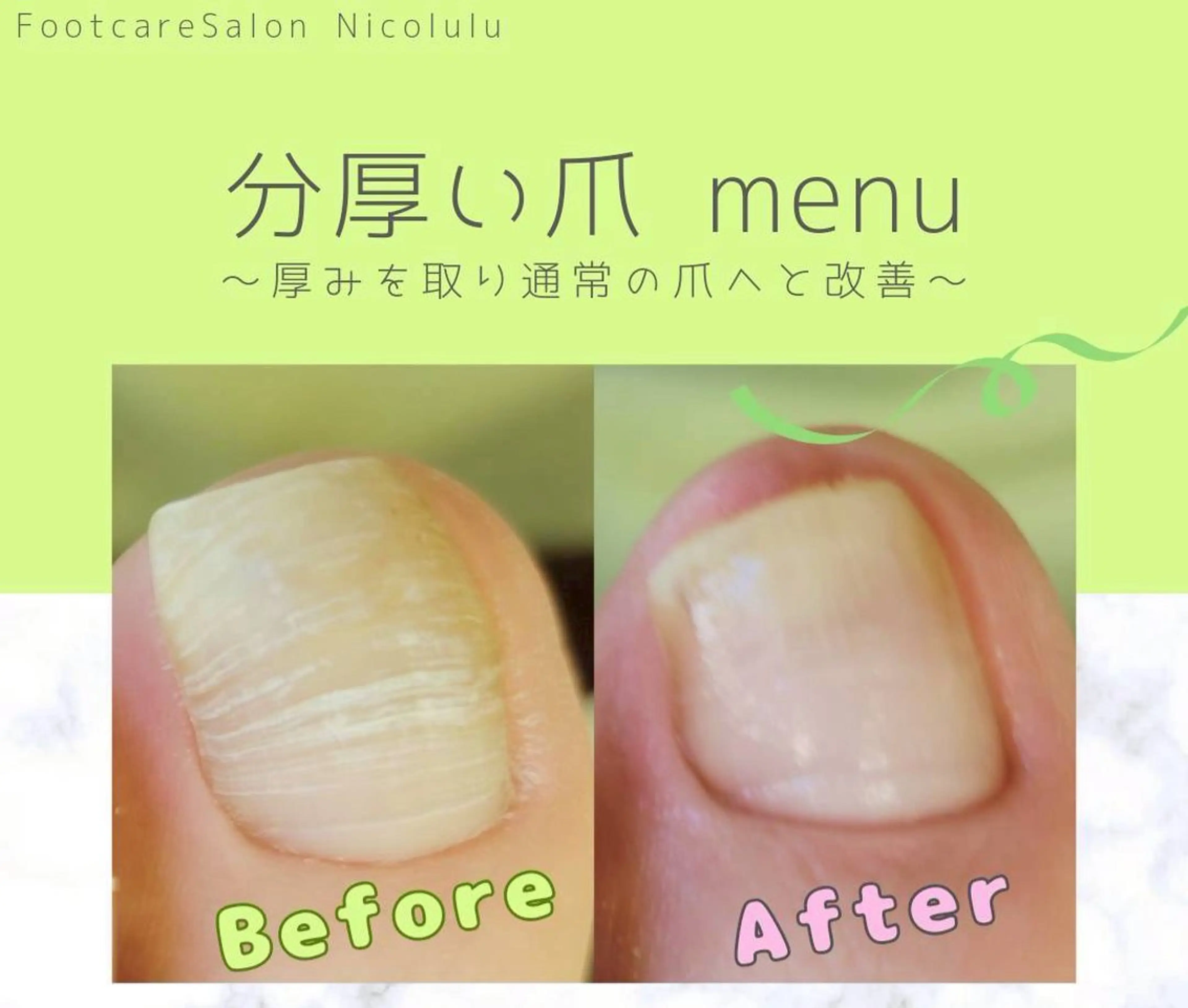 メンズ リラク 足トラブル専門 ニコルル金沢のエステ・リラクイメージ