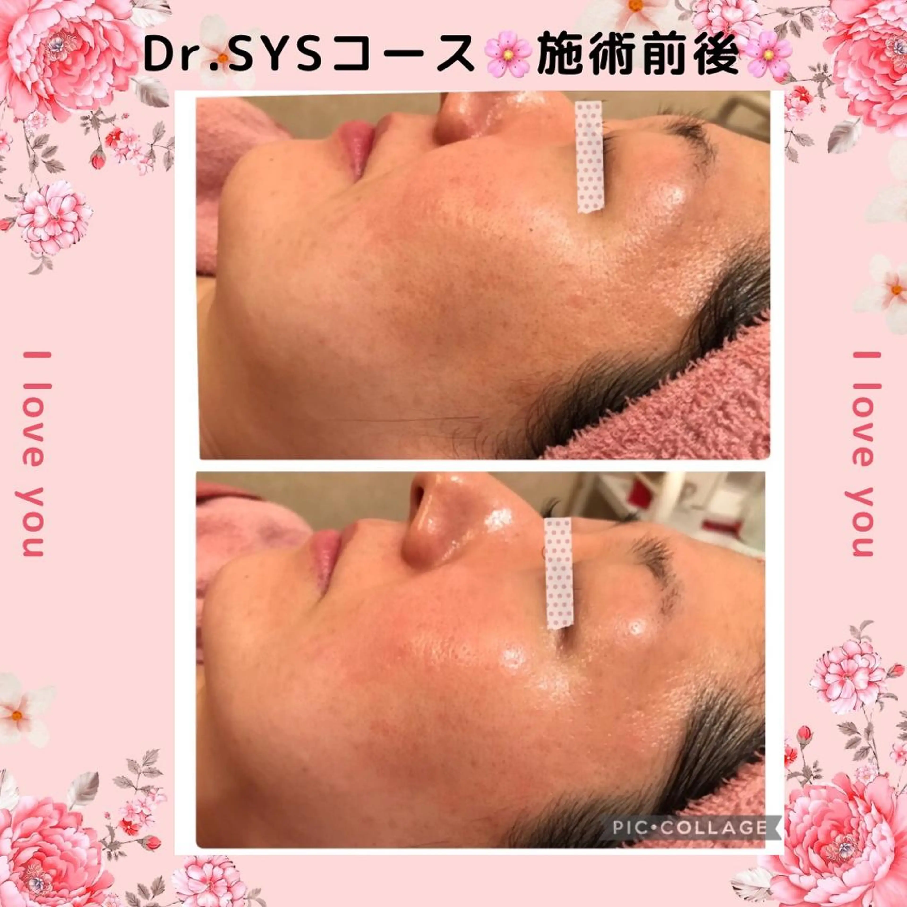 y.laBelle 艶肌・小顔・肌質改善のエステ・リラクイメージ