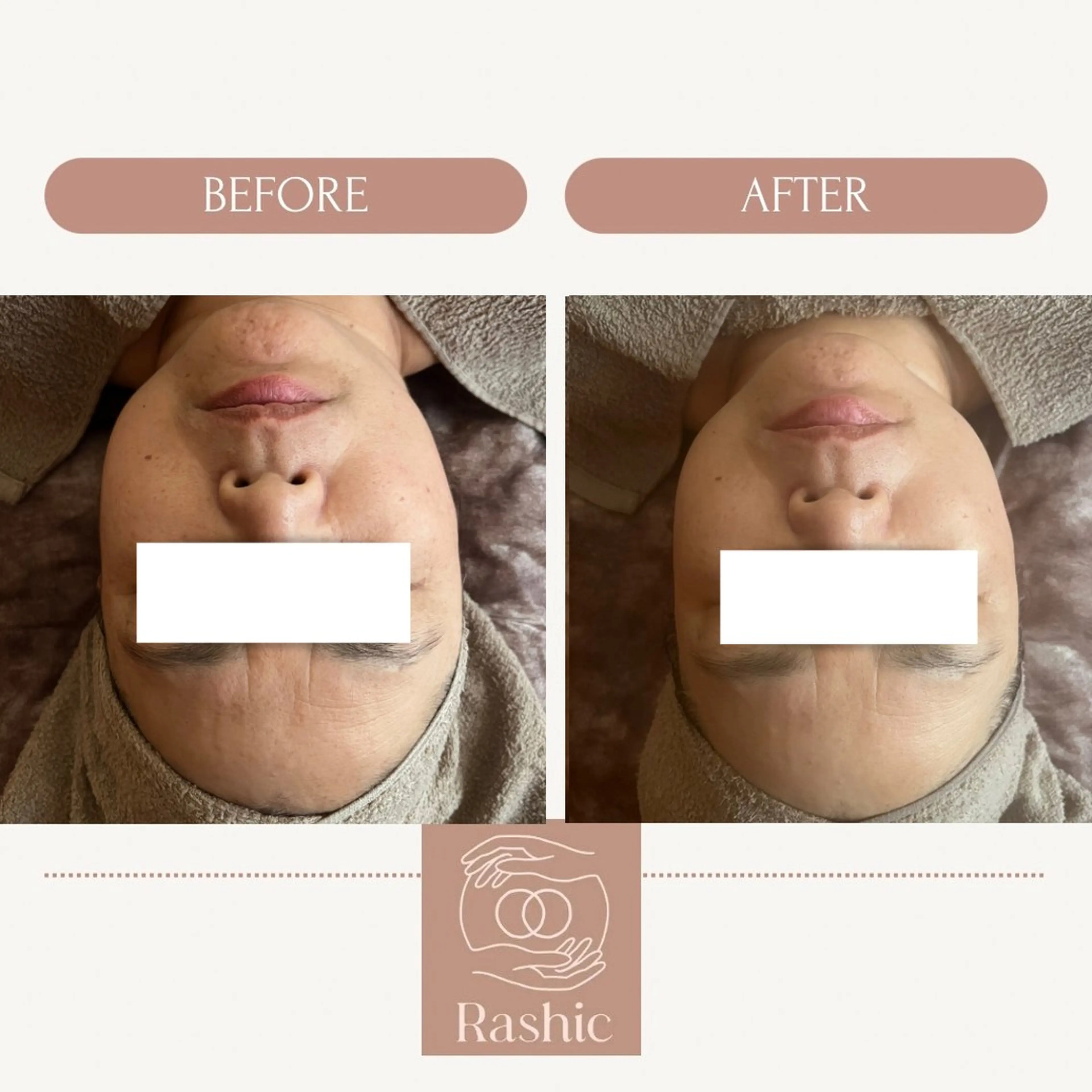 エステ リラク ReN エステサロンのエステ・リラクイメージ