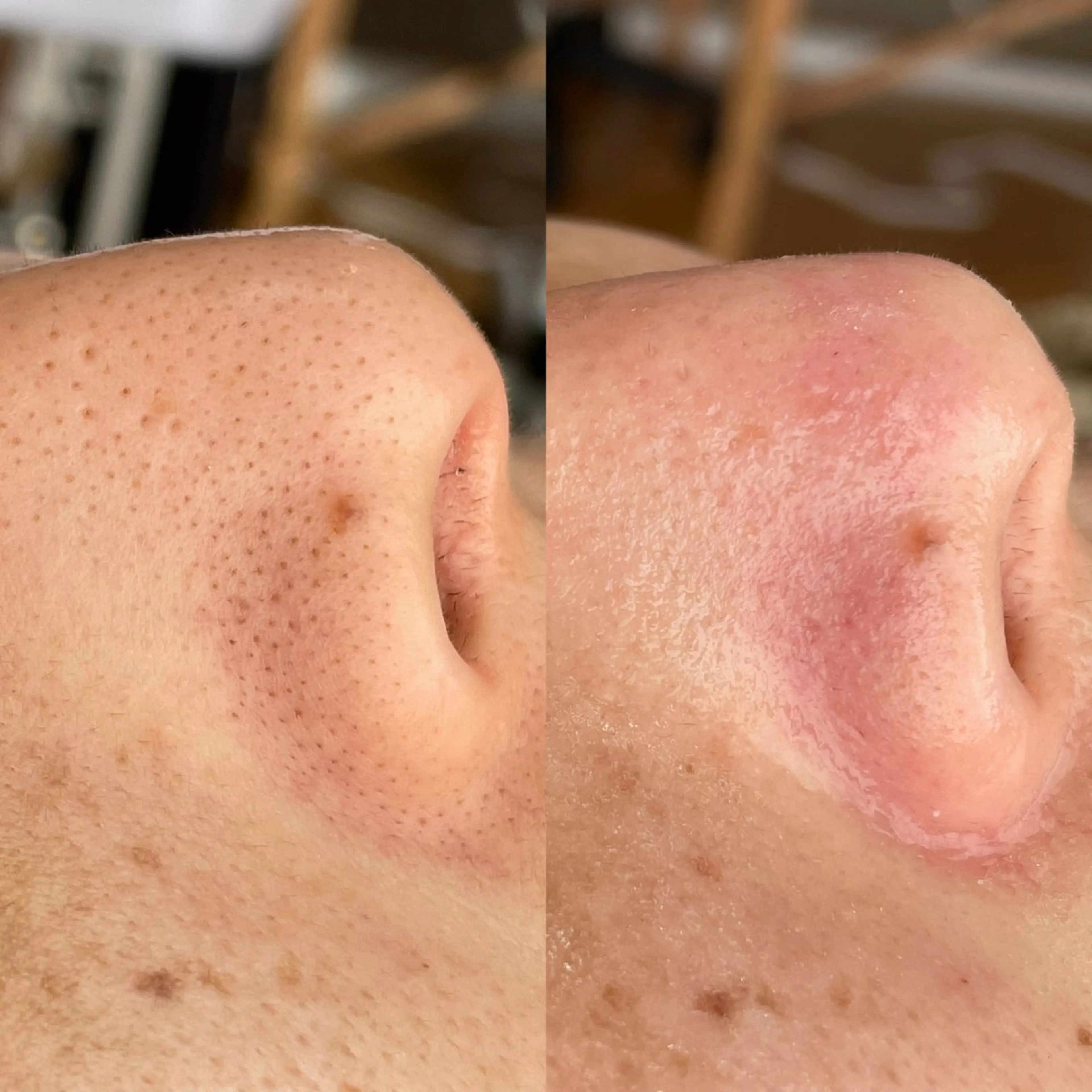 毛穴専門店MeMe.八千代店所属・毛穴・頭皮 専門店💪のその他イメージ