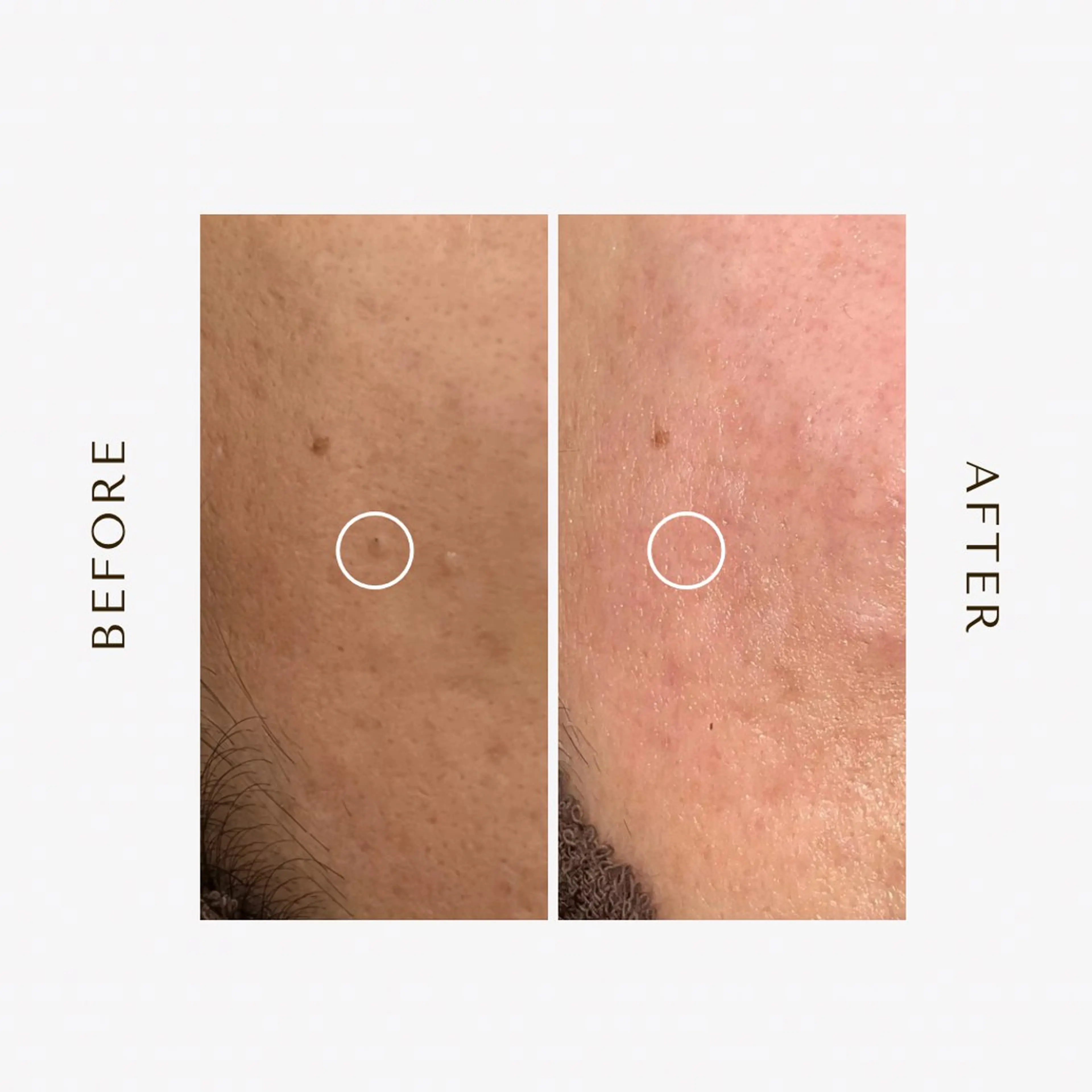 エステ 1st｜フェイシャル エステ専門店のエステ・リラクイメージ