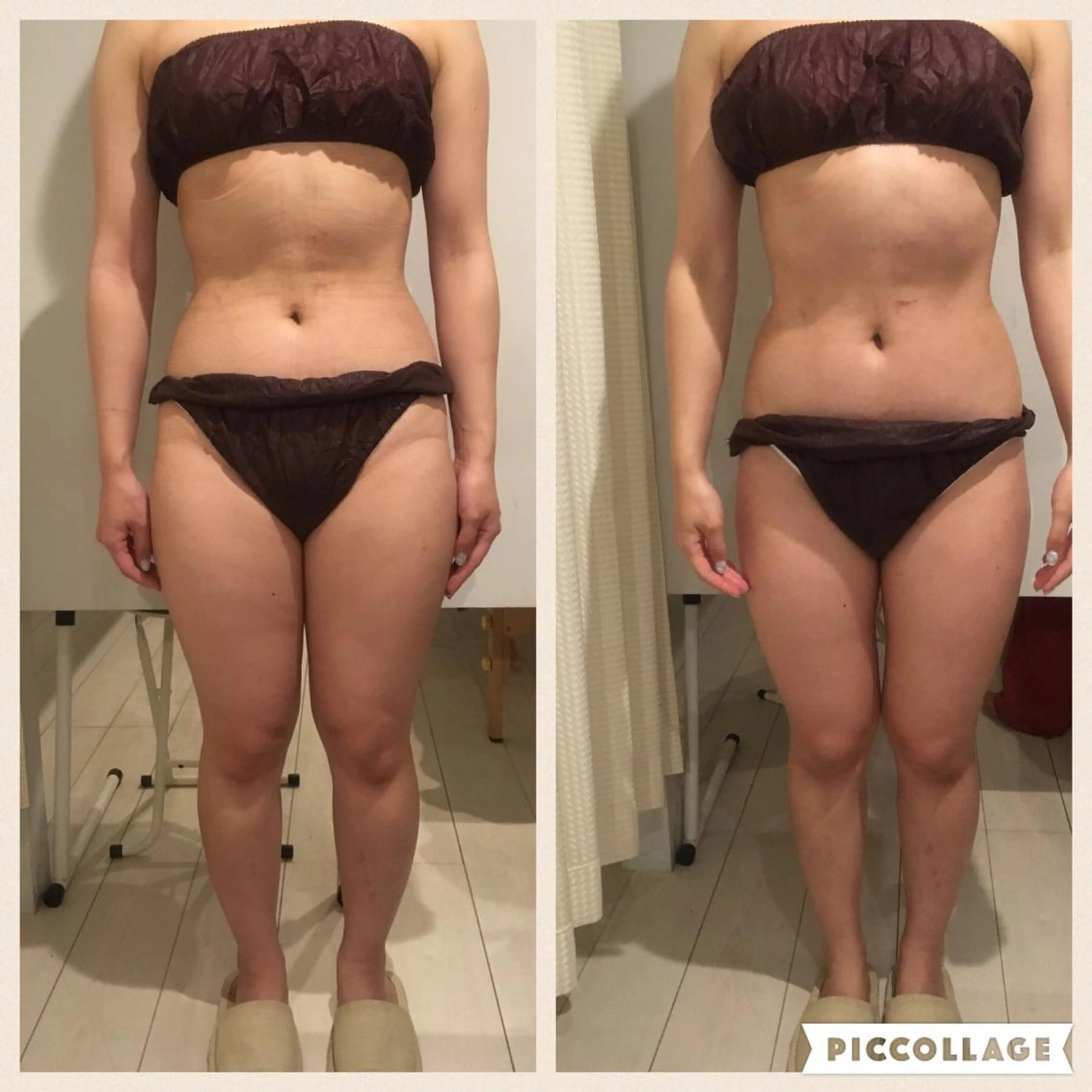 アニメ,Vオタク× 即効痩せエステサロンのエステ・リラクイメージ