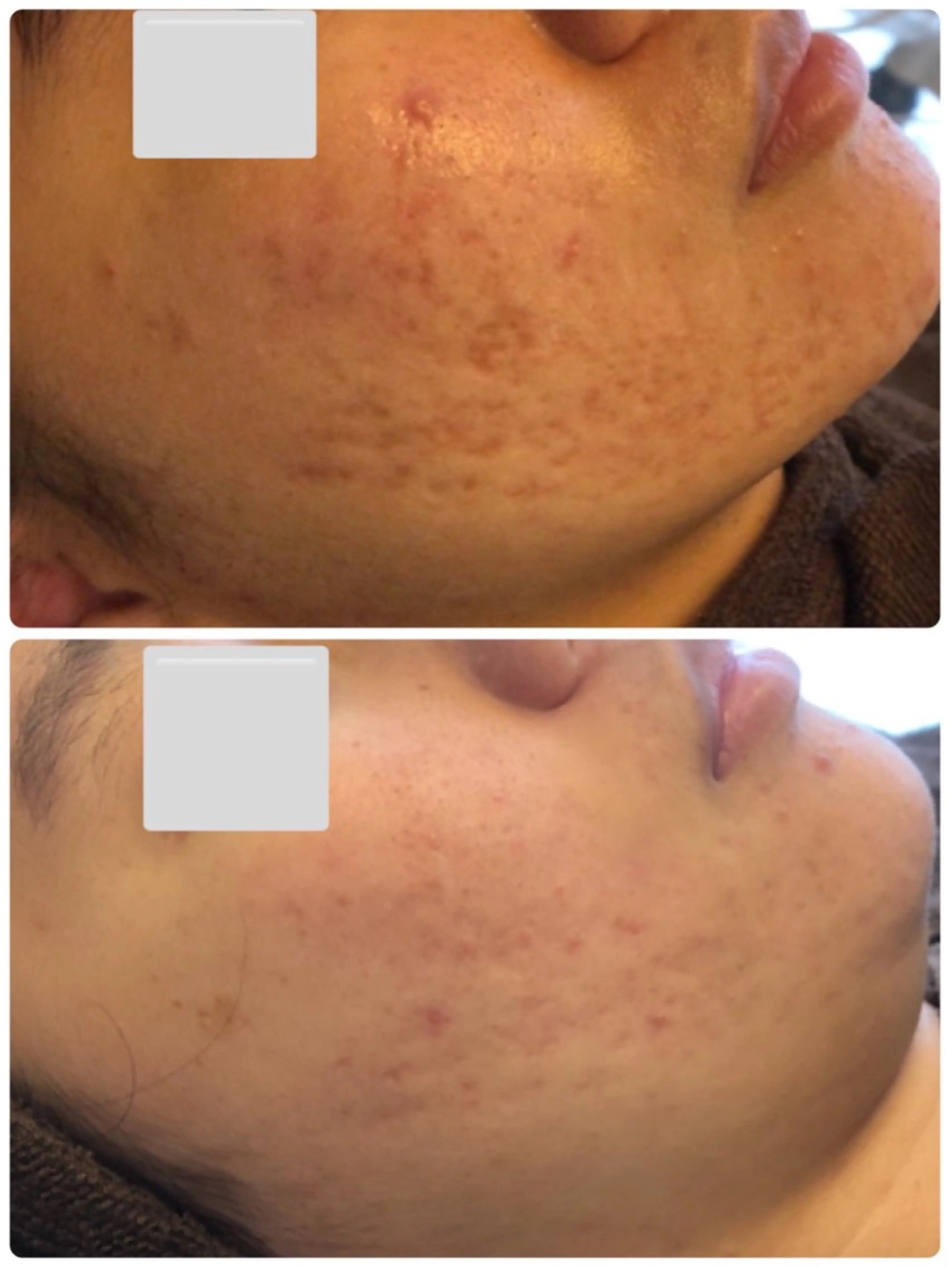 エステ 肌質改善サロン La Divinaのエステ・リラクイメージ