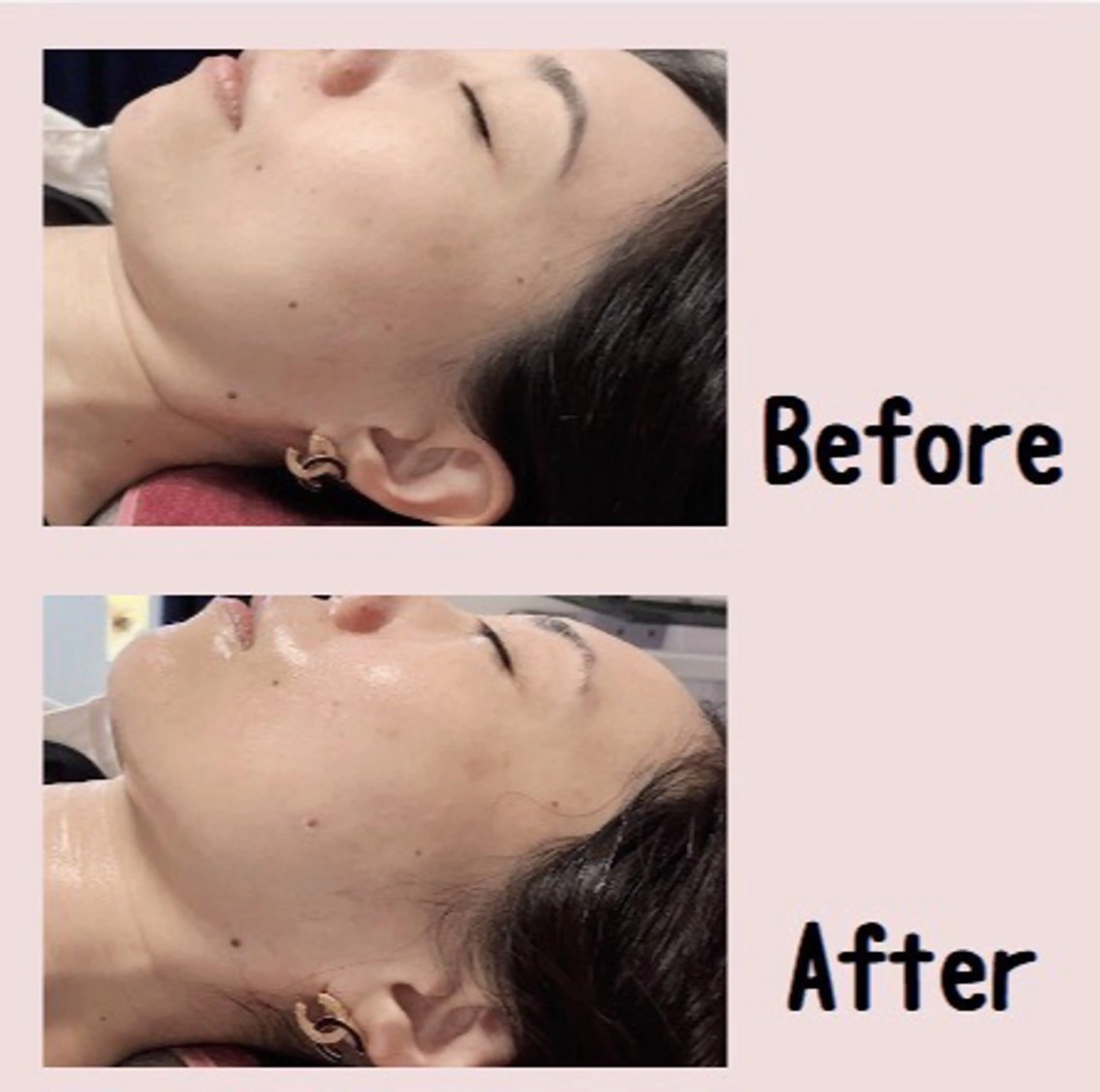 エステ 遠藤 萌のエステ・リラクイメージ