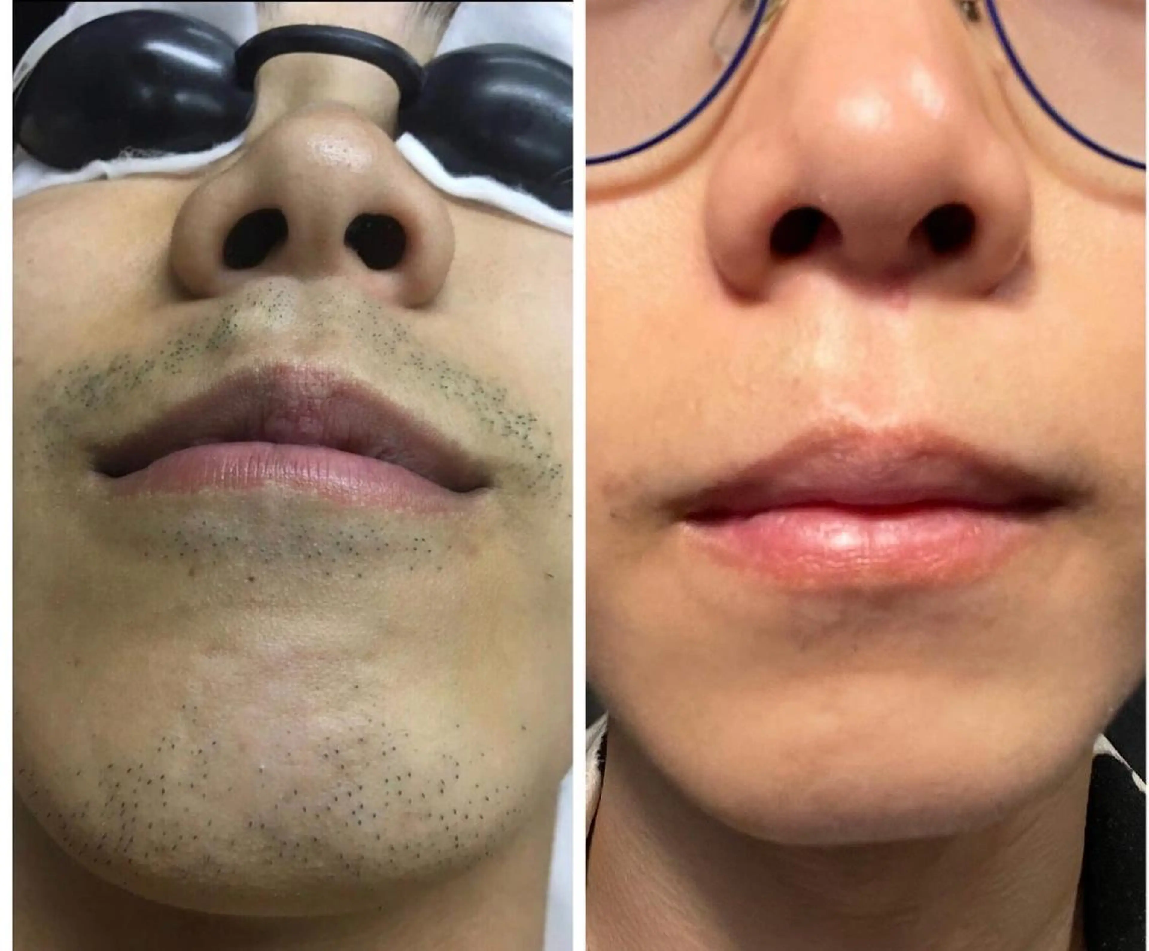 メンズ 脱毛 men's cool 【メンズ脱毛サロン】のエステ・リラクイメージ