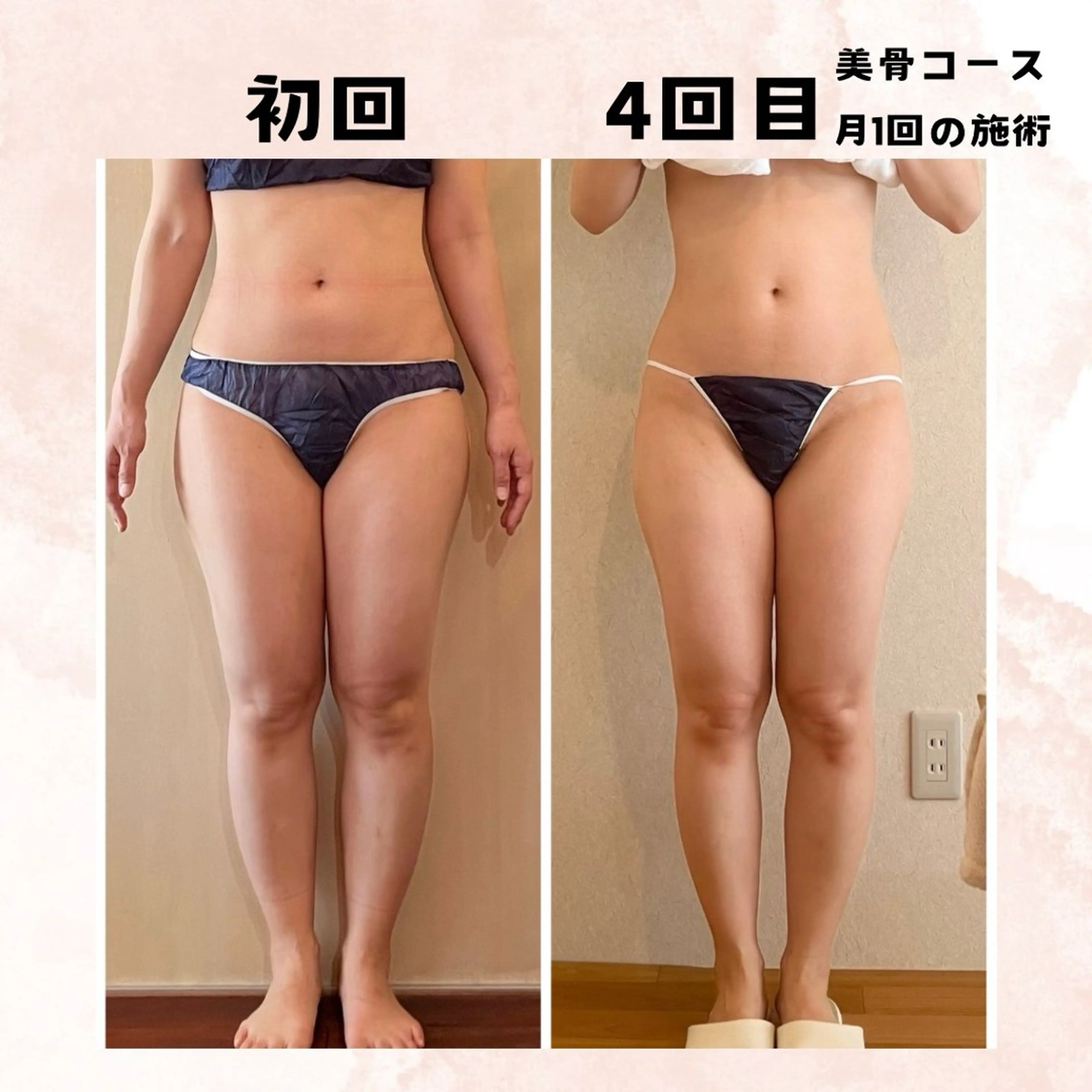 【毛穴&腸もみ】 salon kiwaのエステ・リラクイメージ