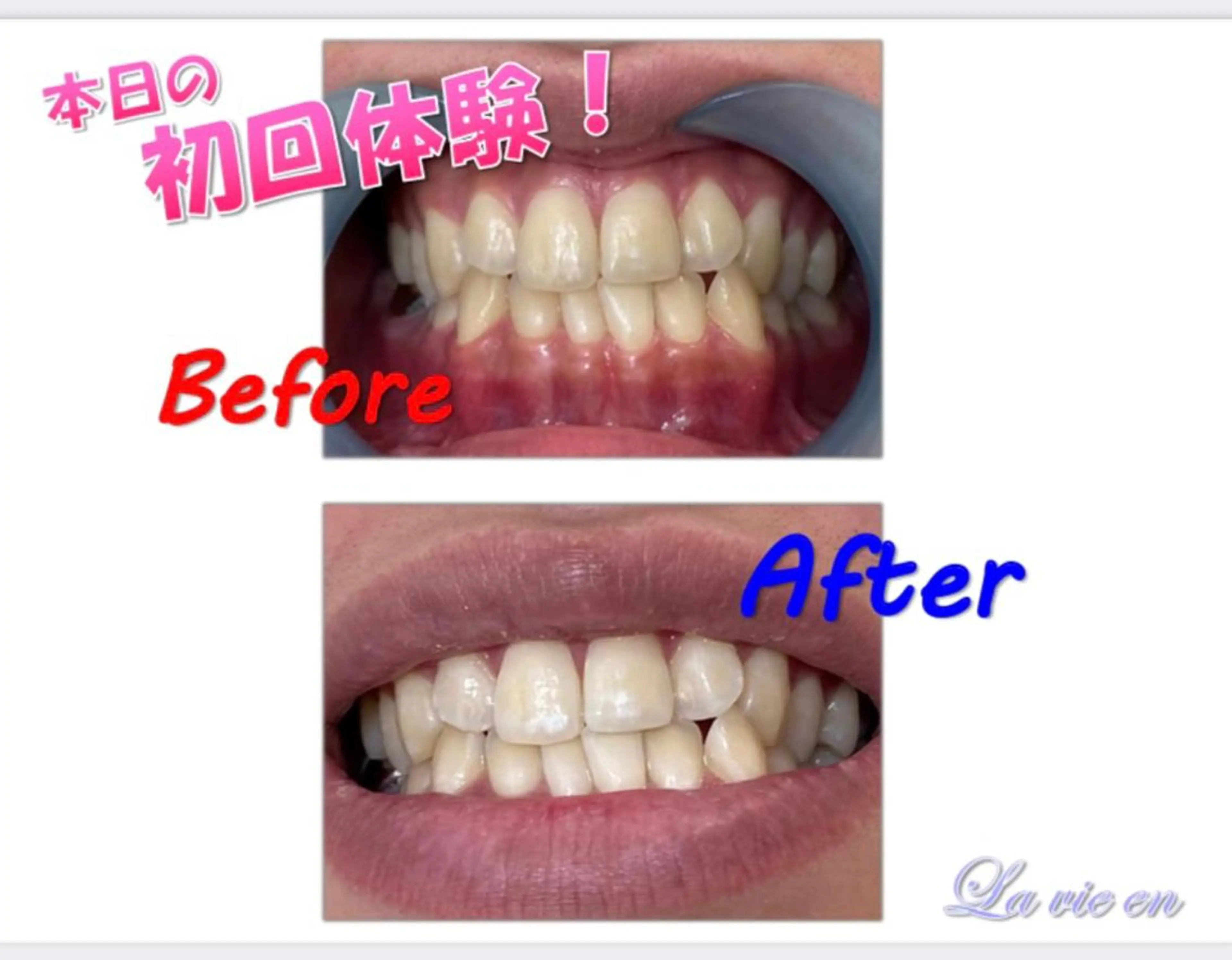 その他 ホワイトニングサロン La vie enのその他イメージ