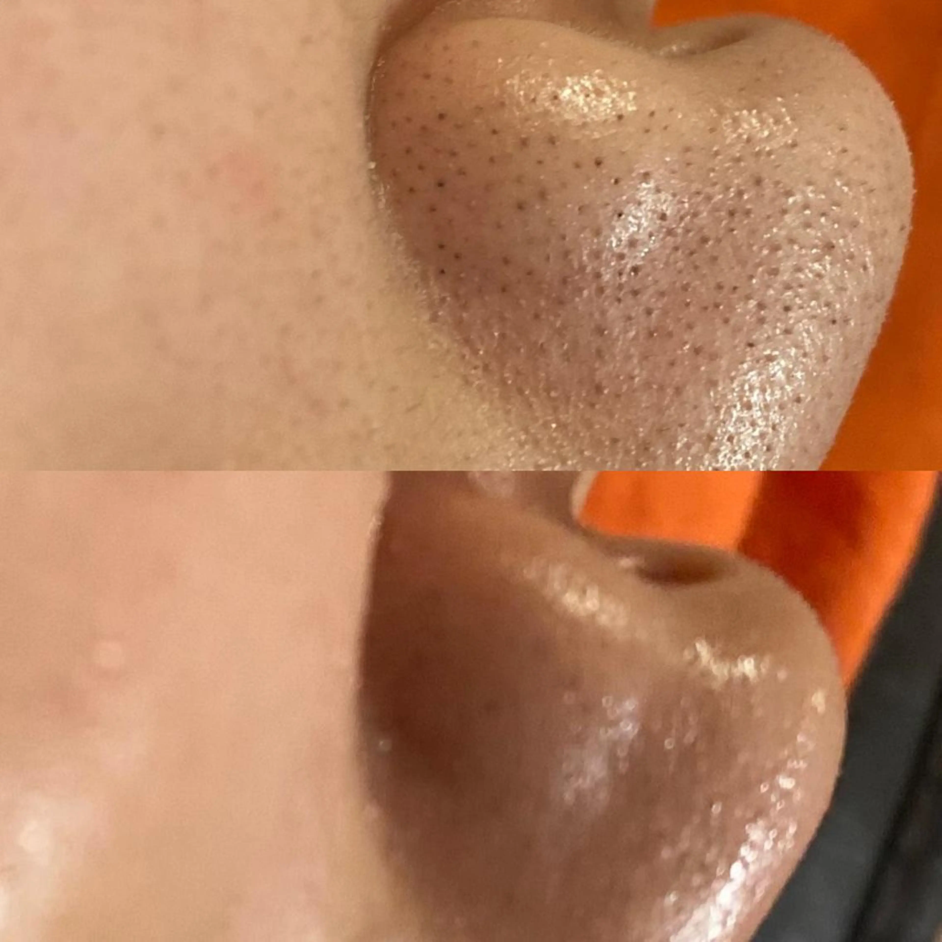 毛穴から始める肌メン テマンダリンオレンジのエステ・リラクイメージ