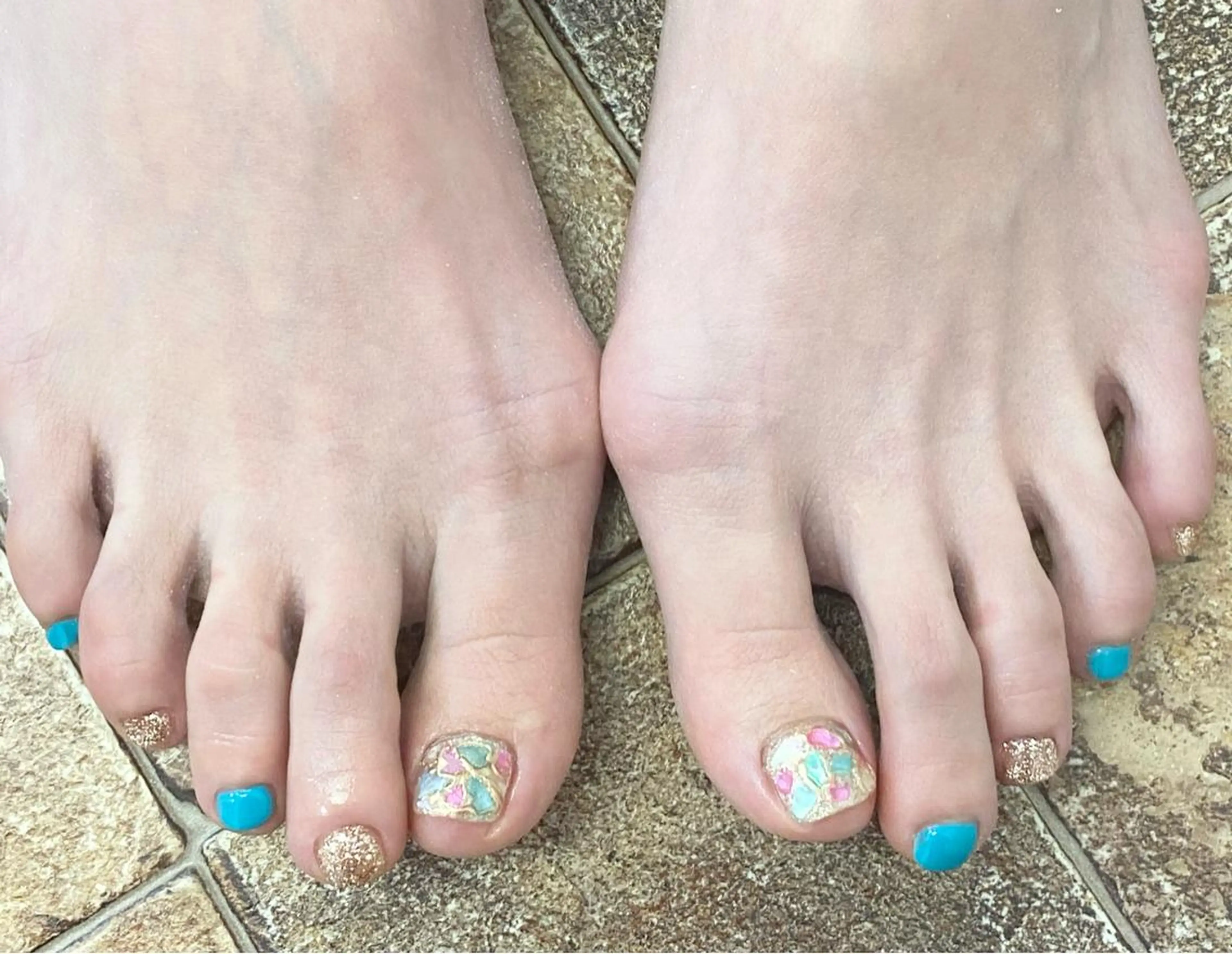 フット親指デザインメニューの写真